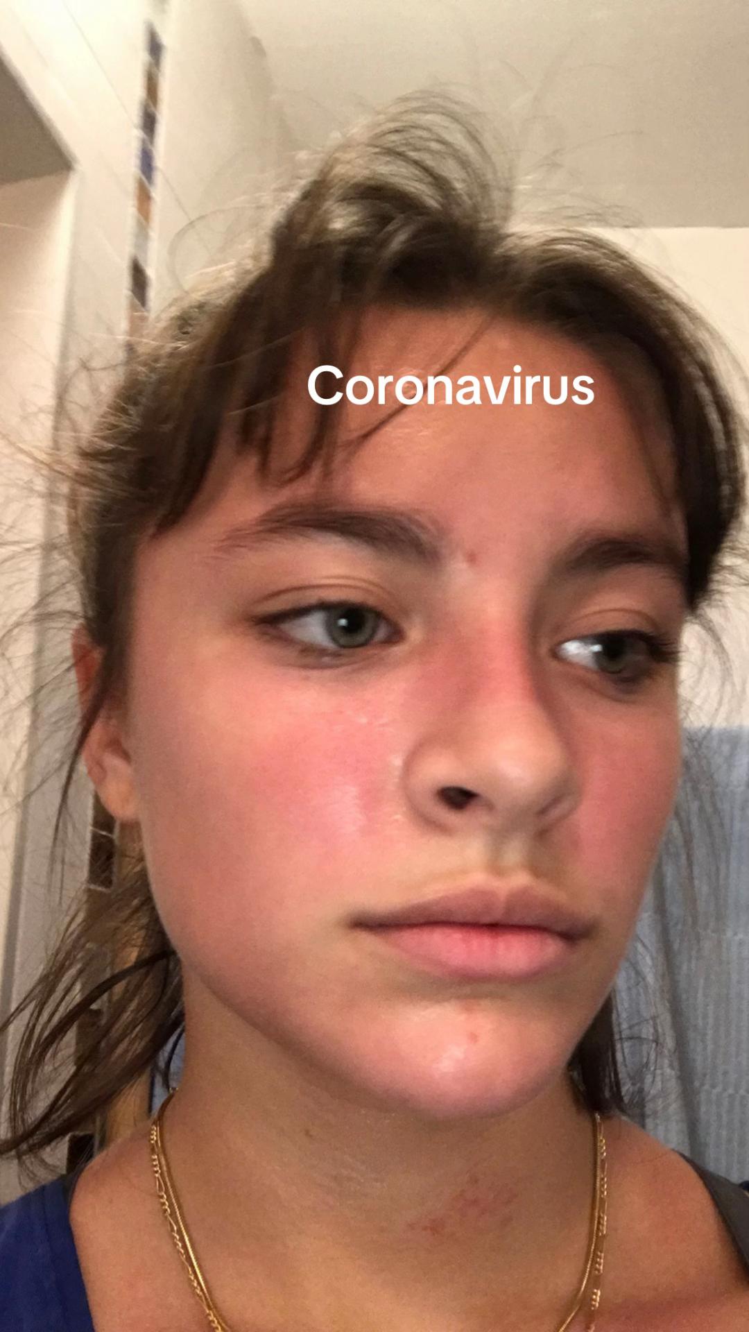 @straawnilla