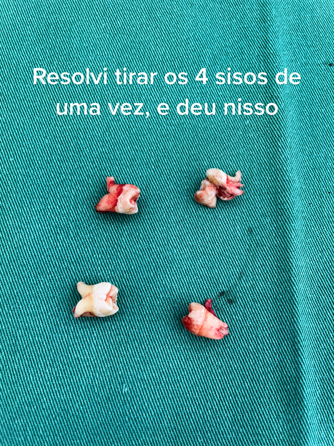 @Carla
