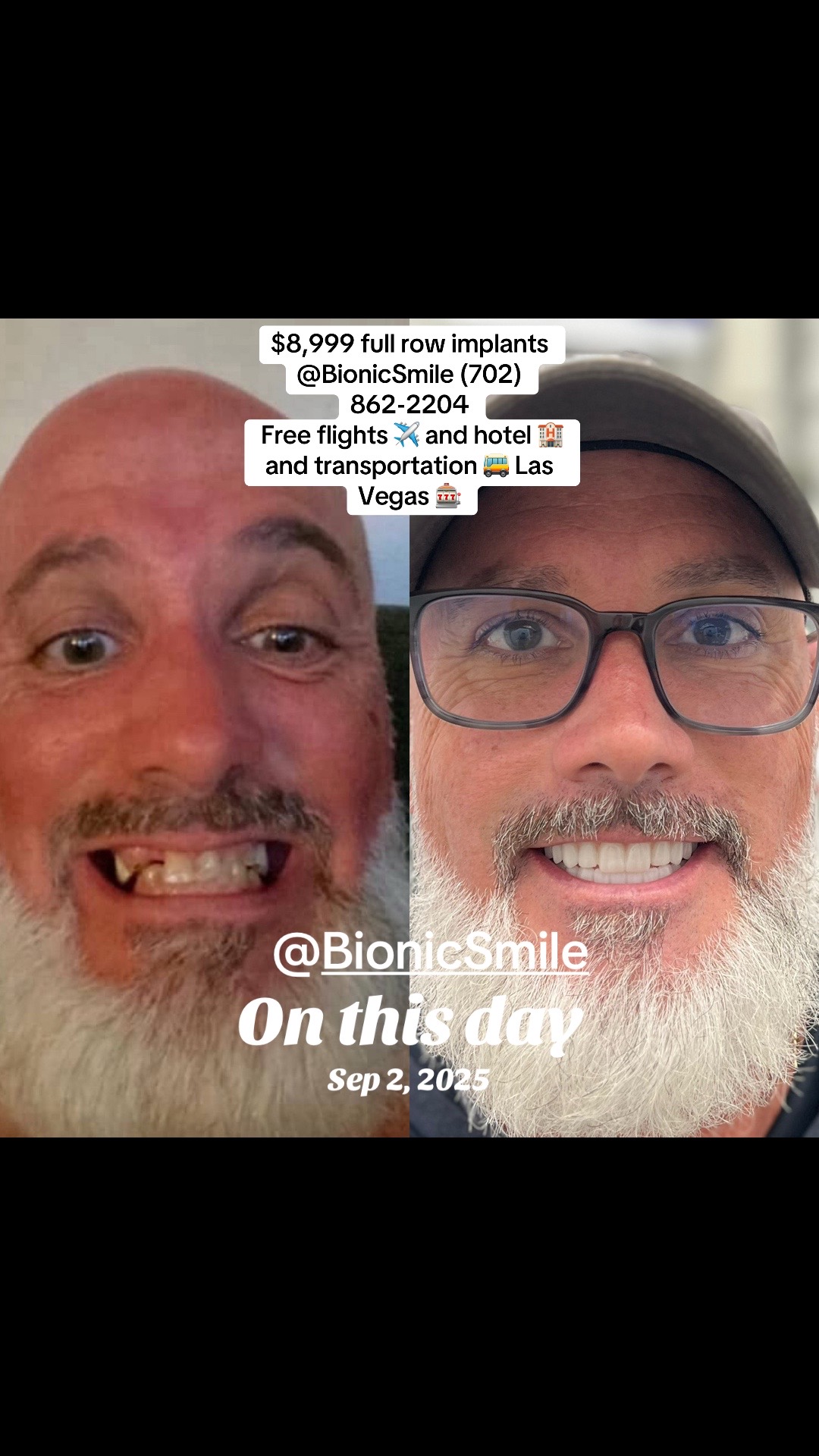 @BionicSmilewithShay