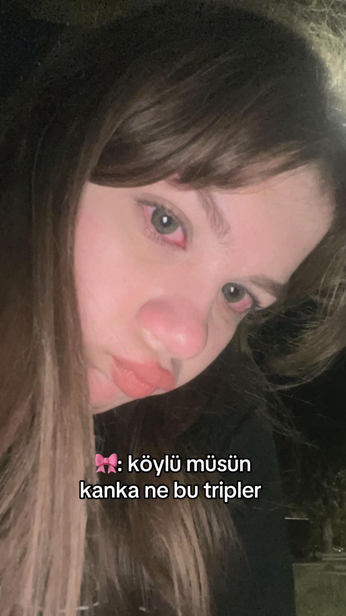 @esra