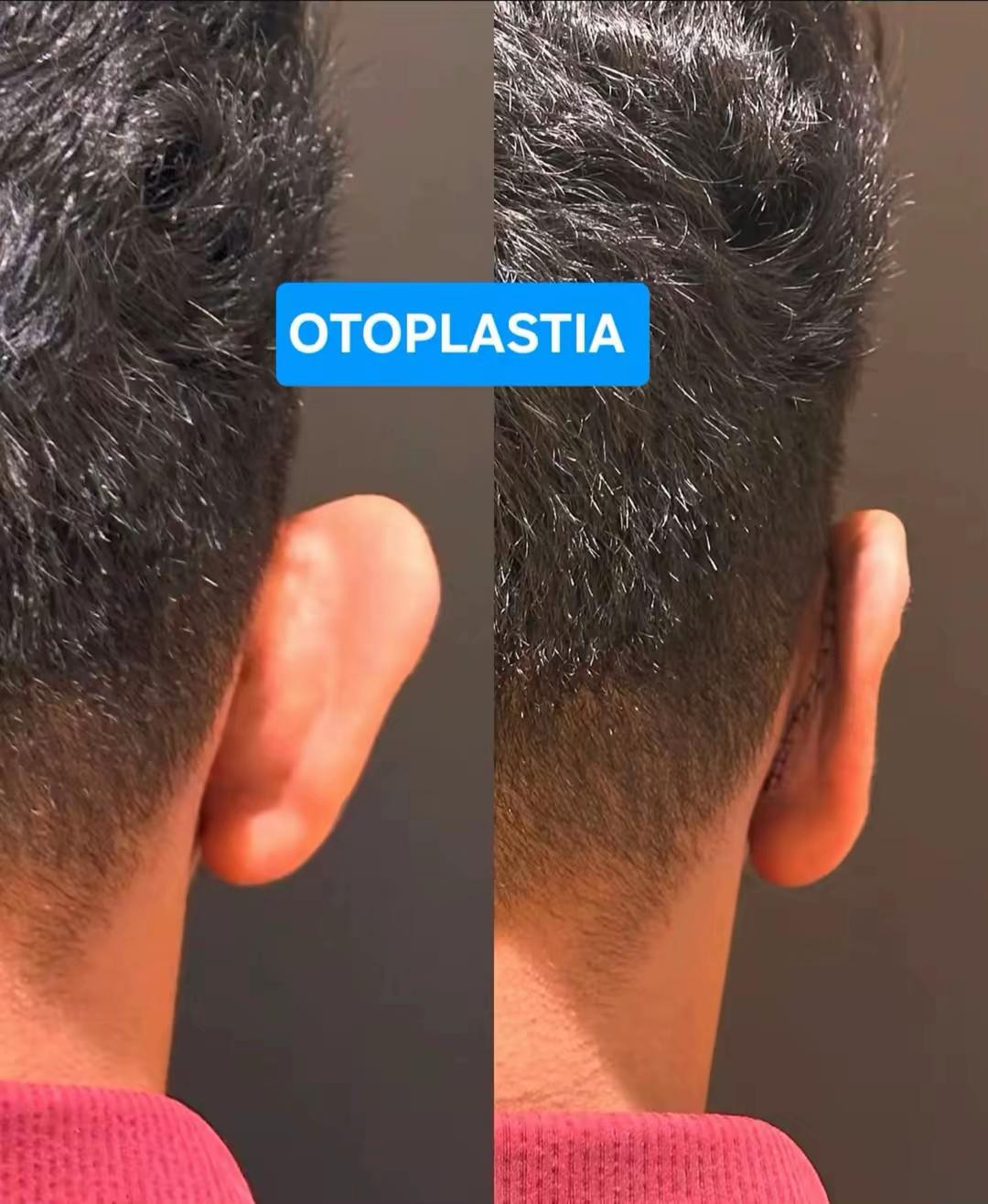 @Belanovacirugiaplastica