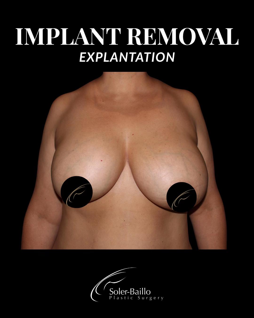 @Soler Baillo Plastic Surgery