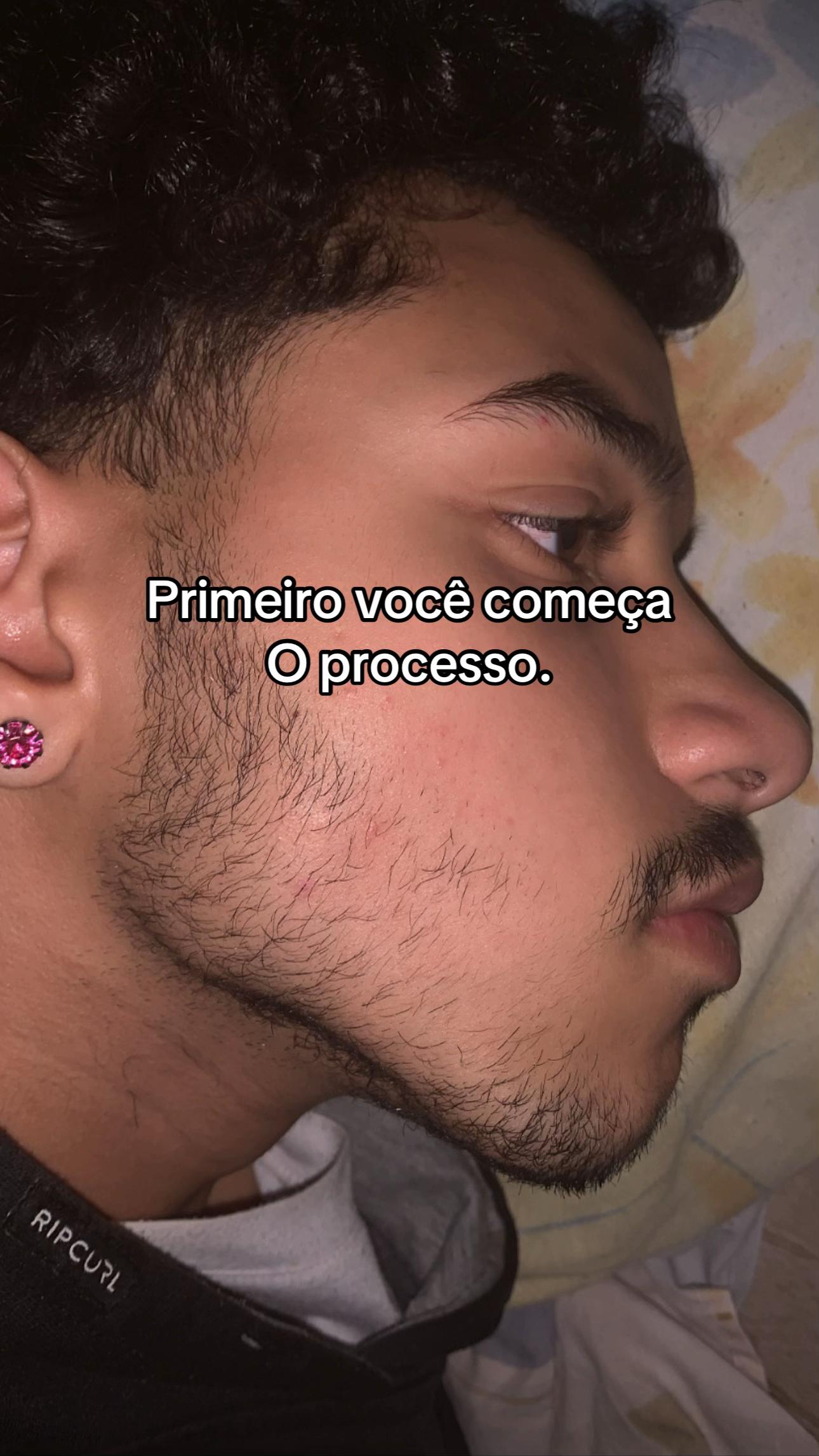 @Pires