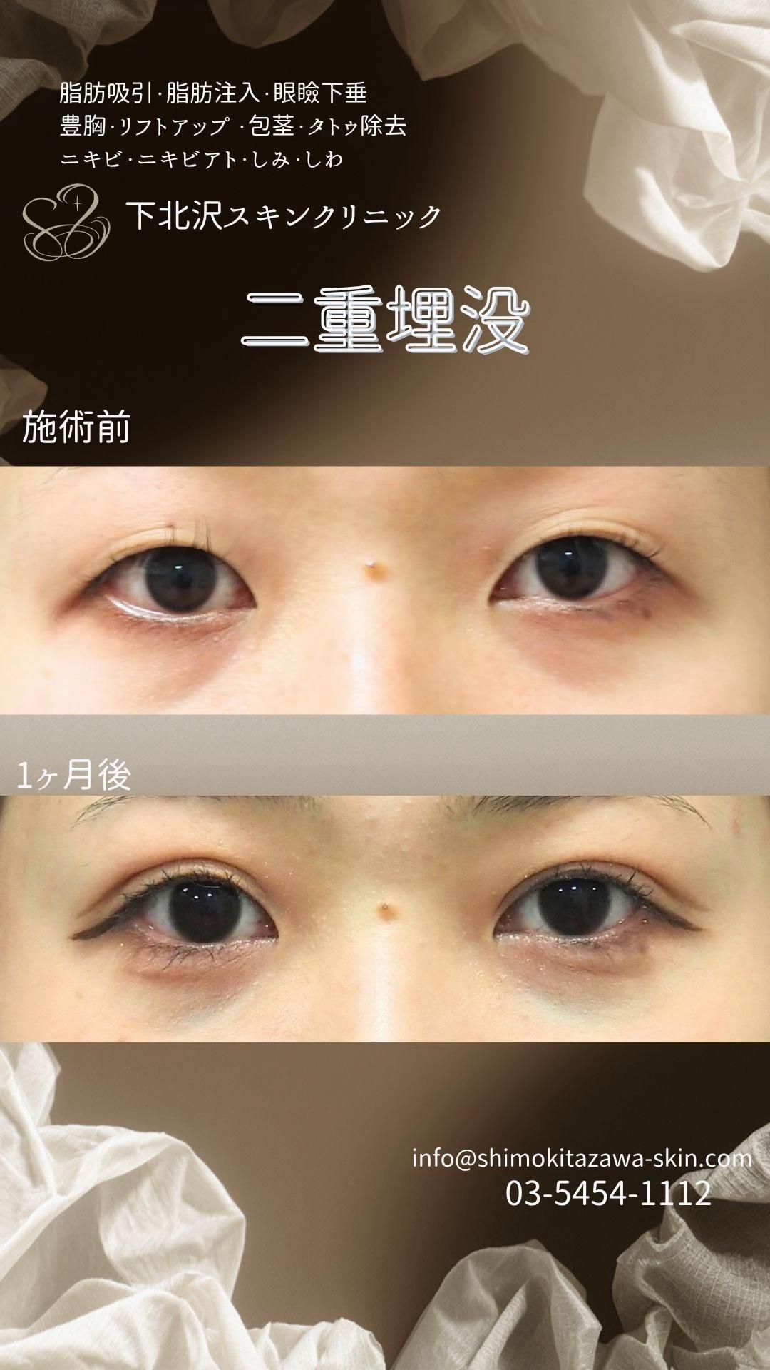 @下北沢スキンクリニック院長・こころの美容外科医・保坂宗孝