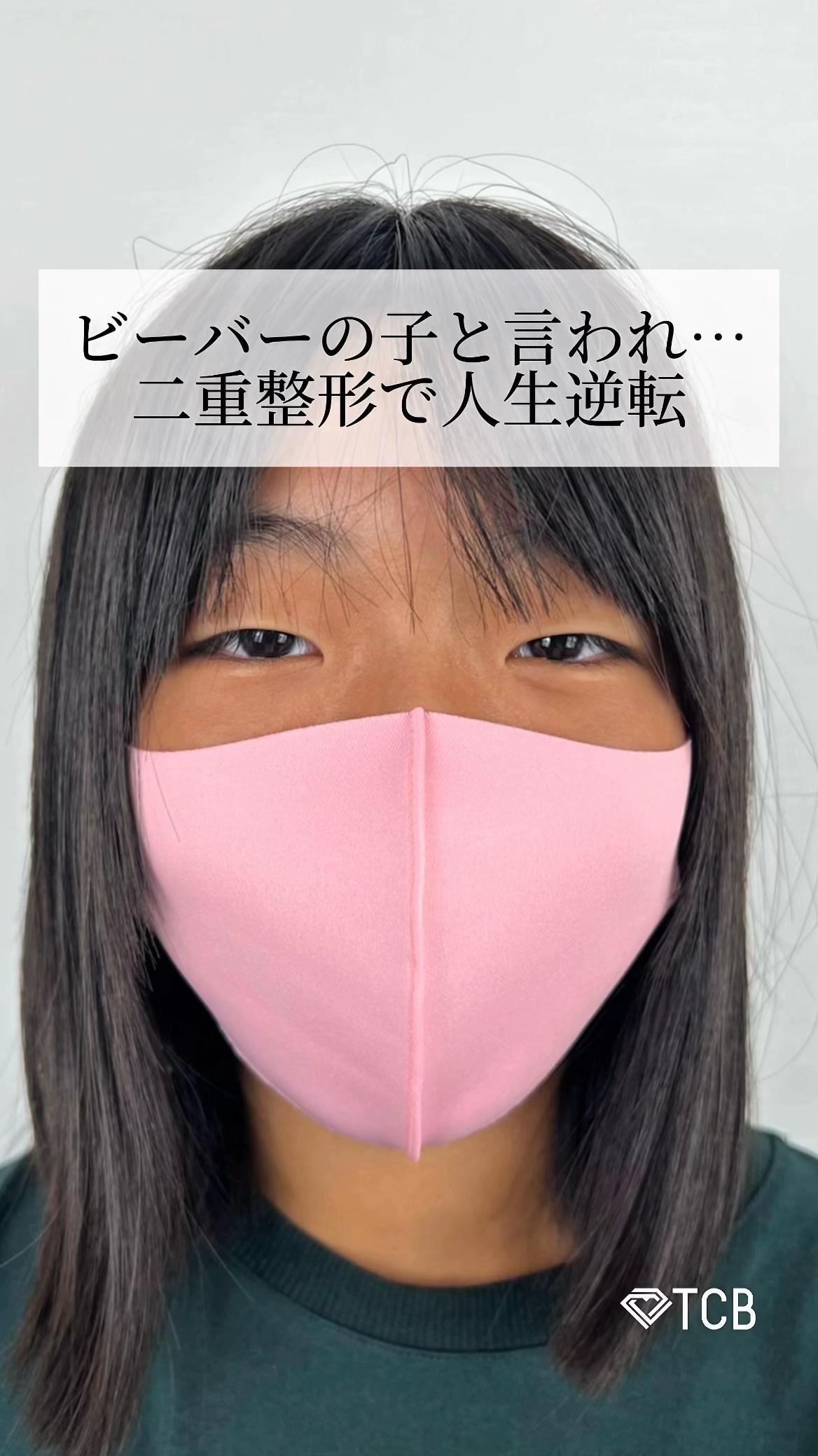 @【二重整形】TCB 新宿東口院ゆいこ先生/東京