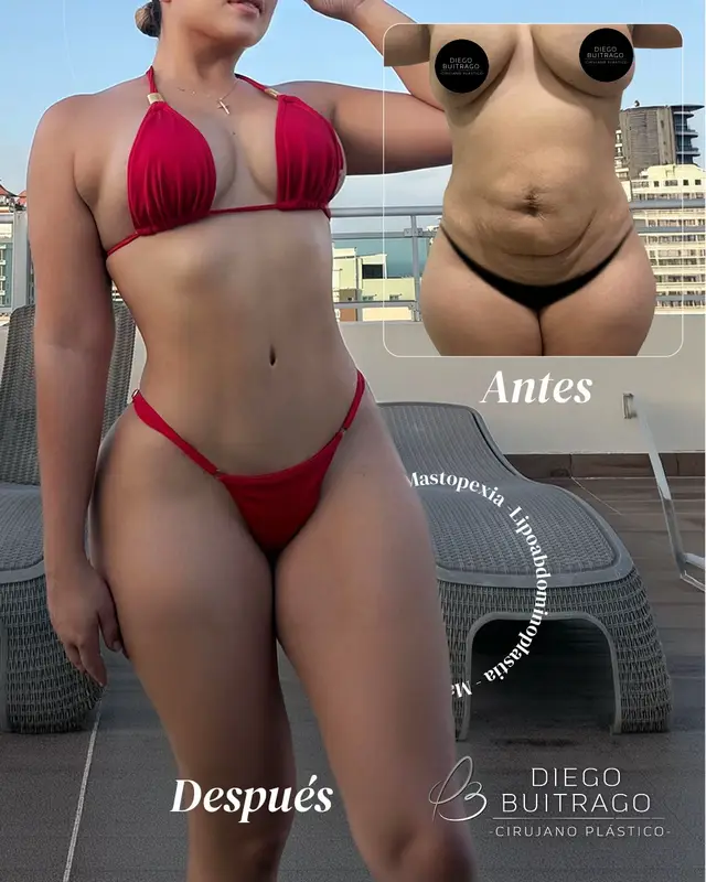 @Drdiegobuitrago