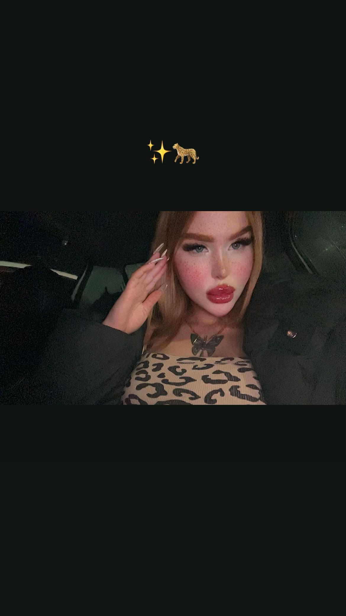 @Lina