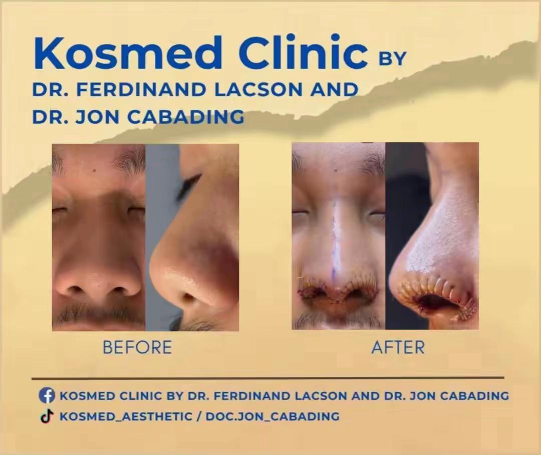 @doc.jon_cabading