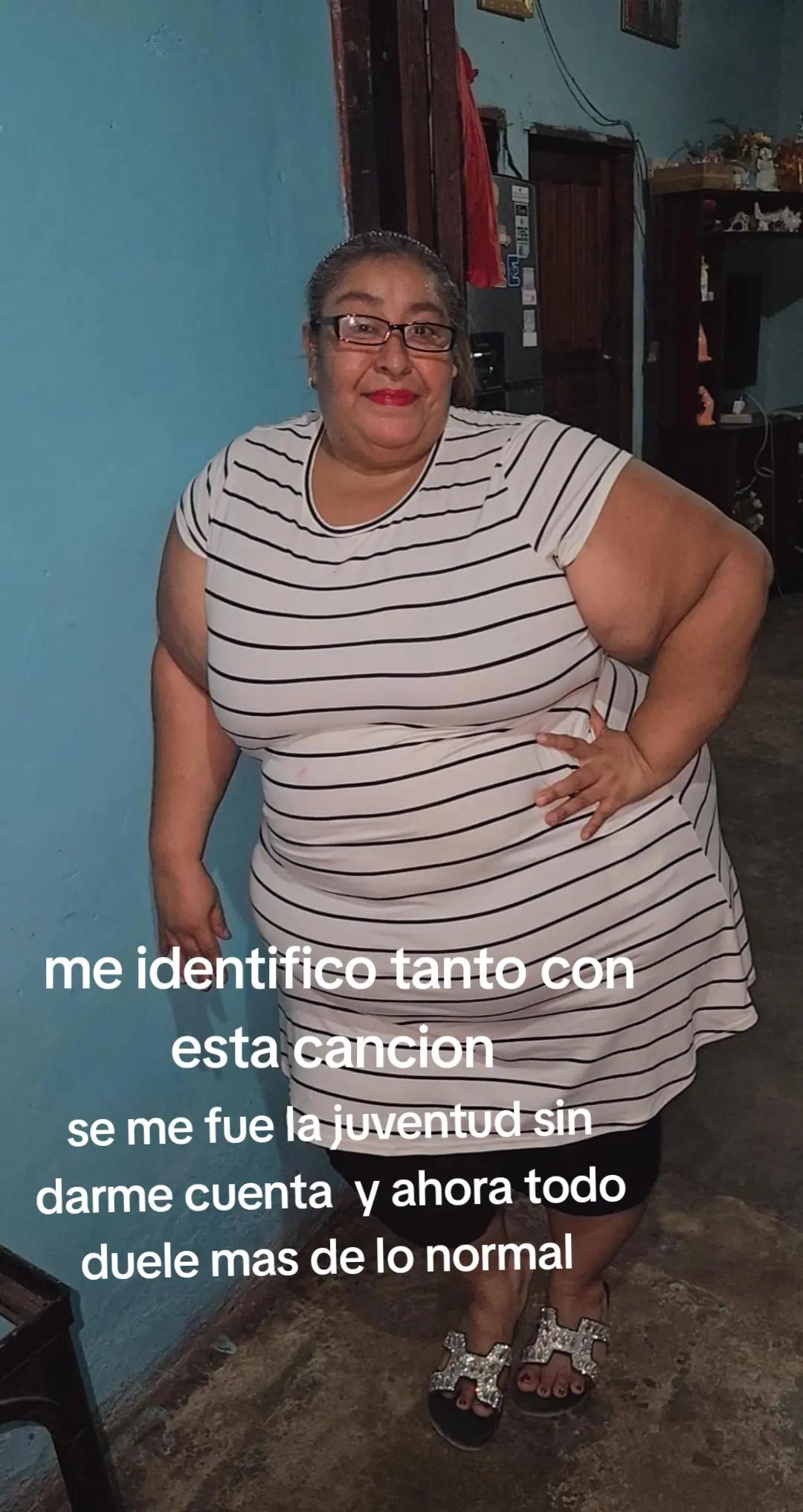 @Delmis molina