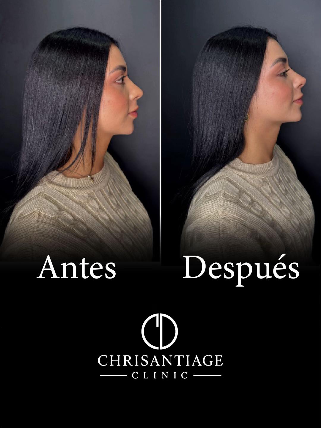 @chrisantiage