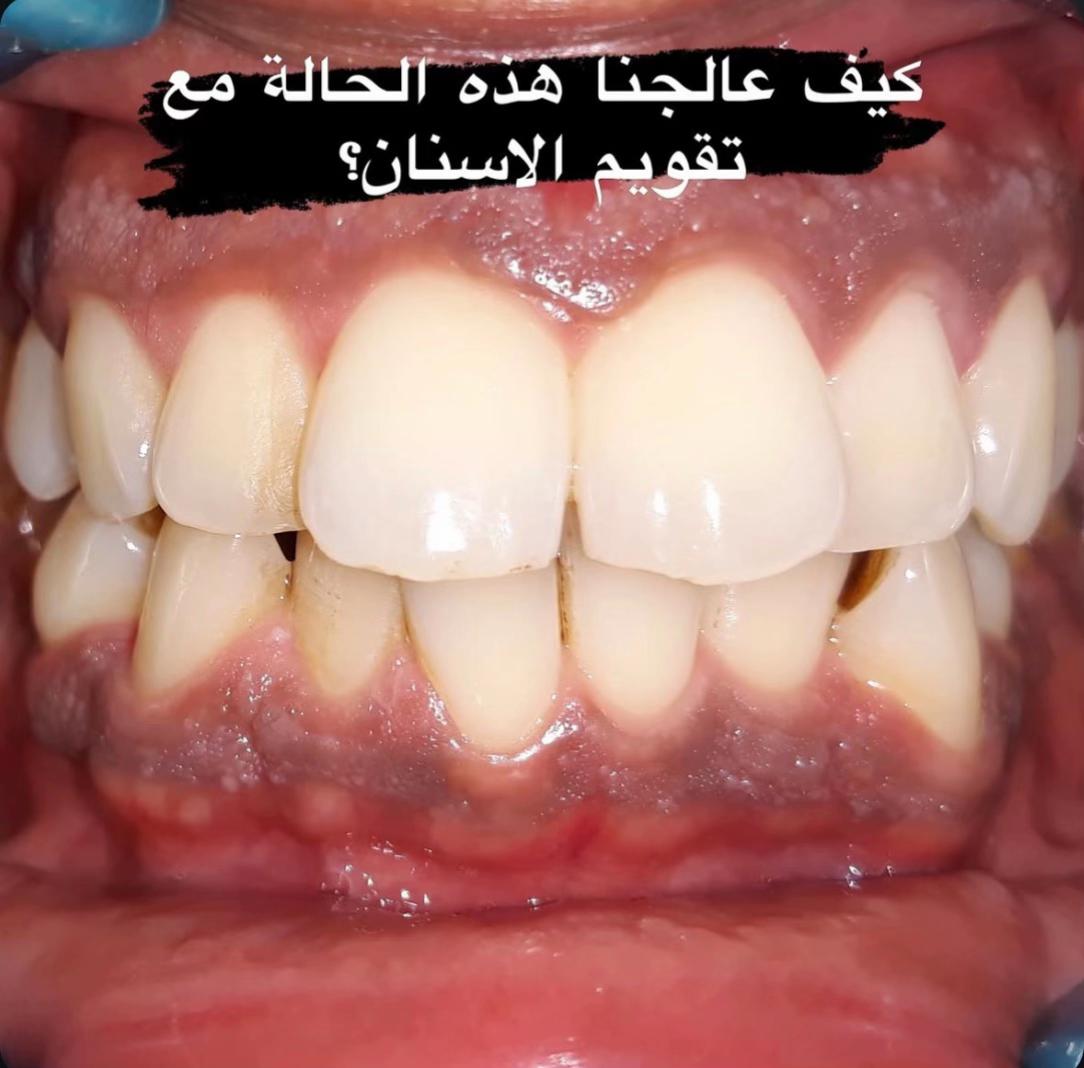 @Dr Tayssir Seddik