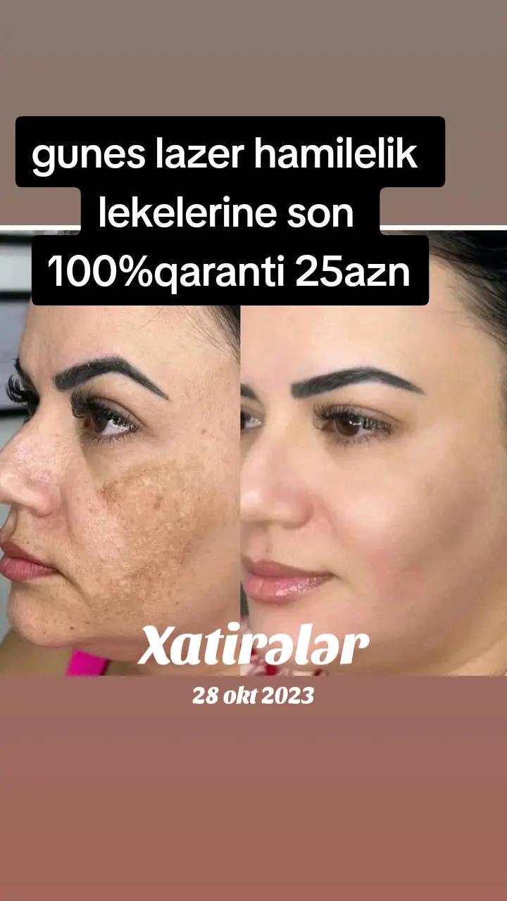 @gozellik_mekani