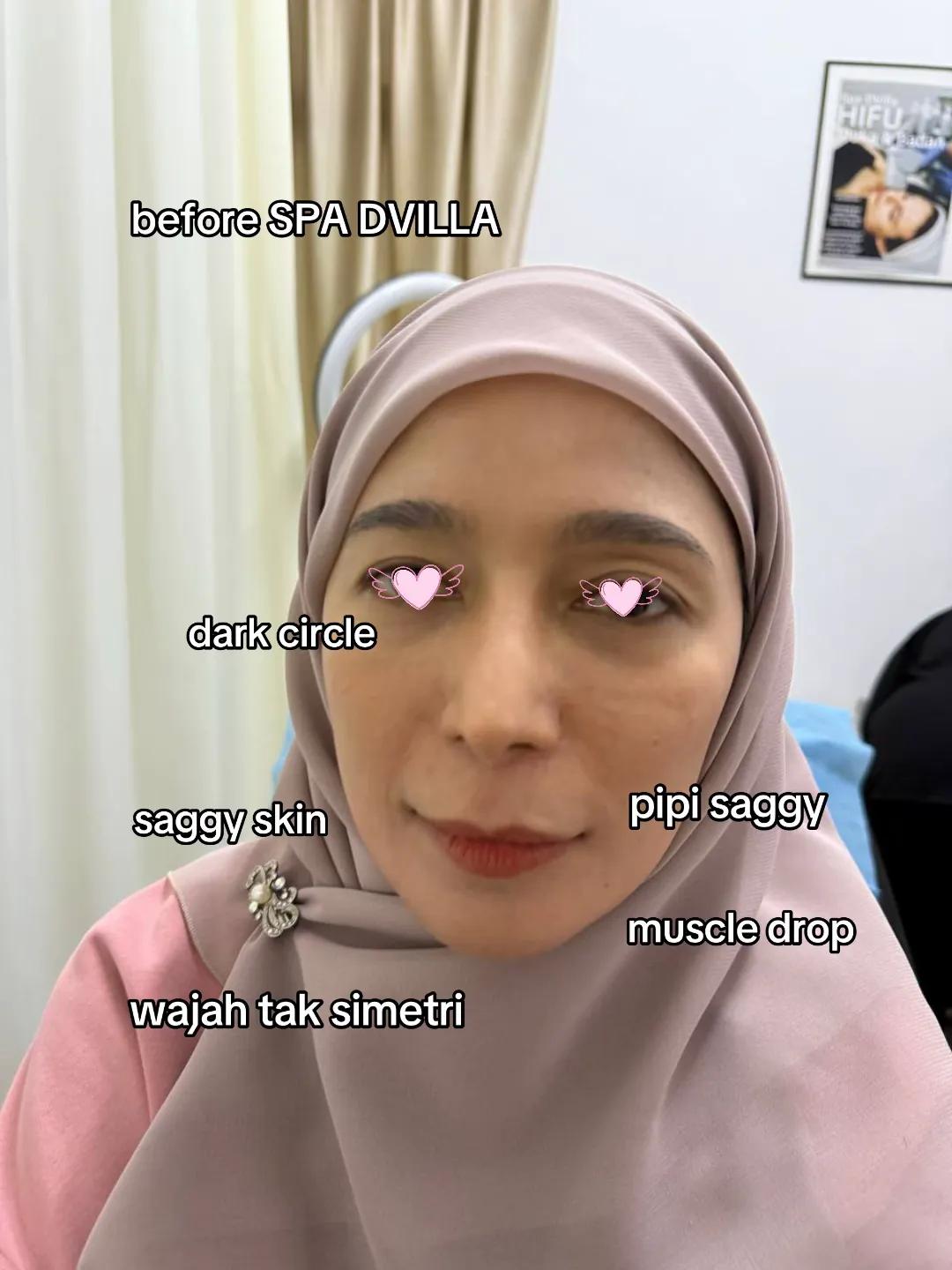 @SPA DVILLA SKIN & SLIM EXPERT