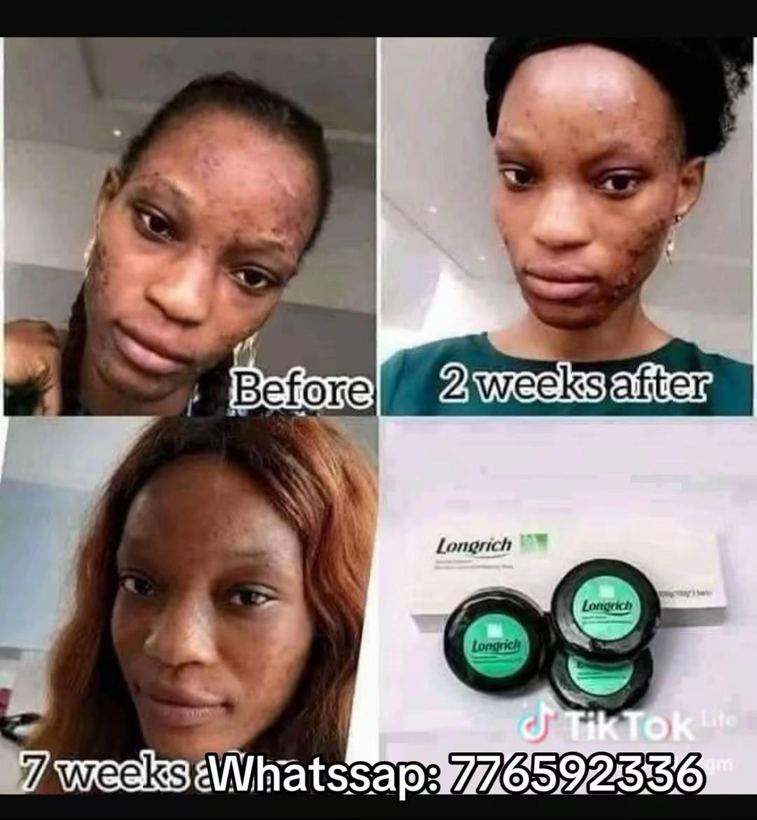 @Longrich_senegal