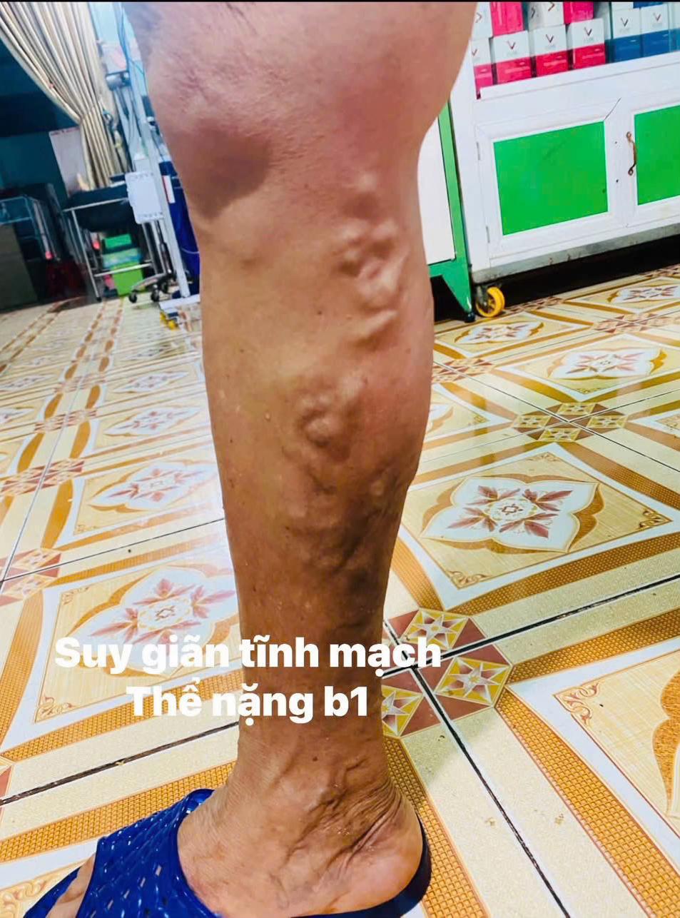 @Shop Anh Trần Spa