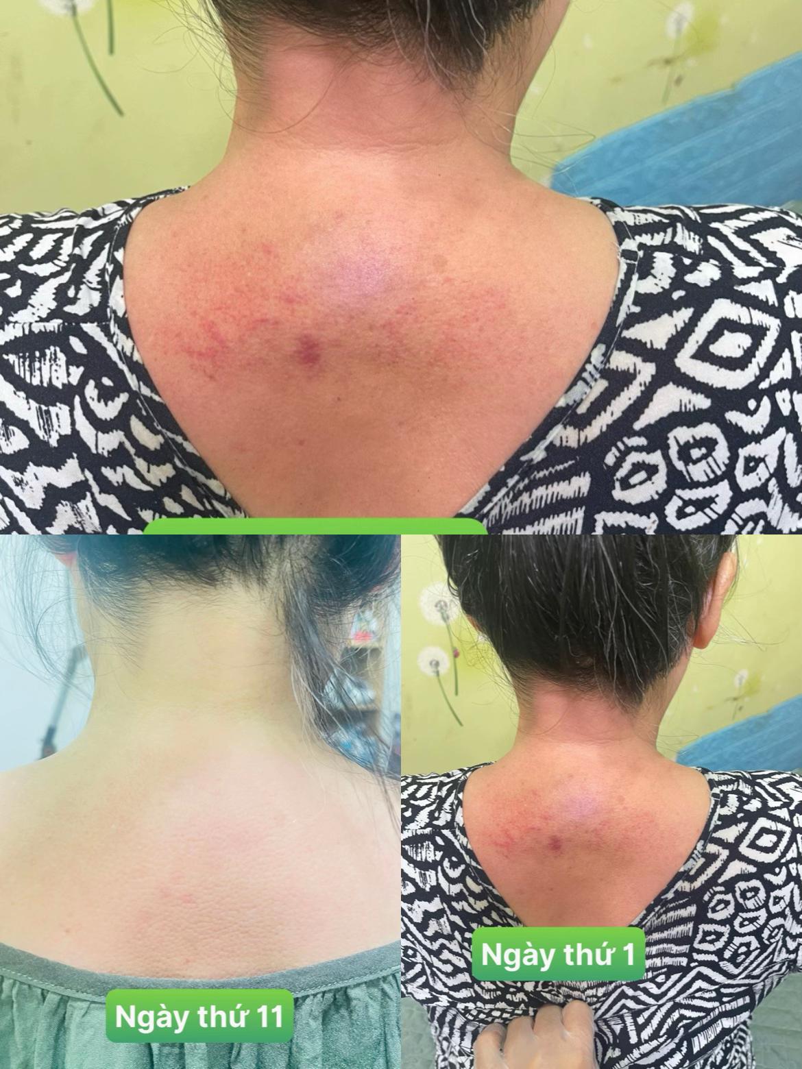 @Dr Nguyễn Hữu