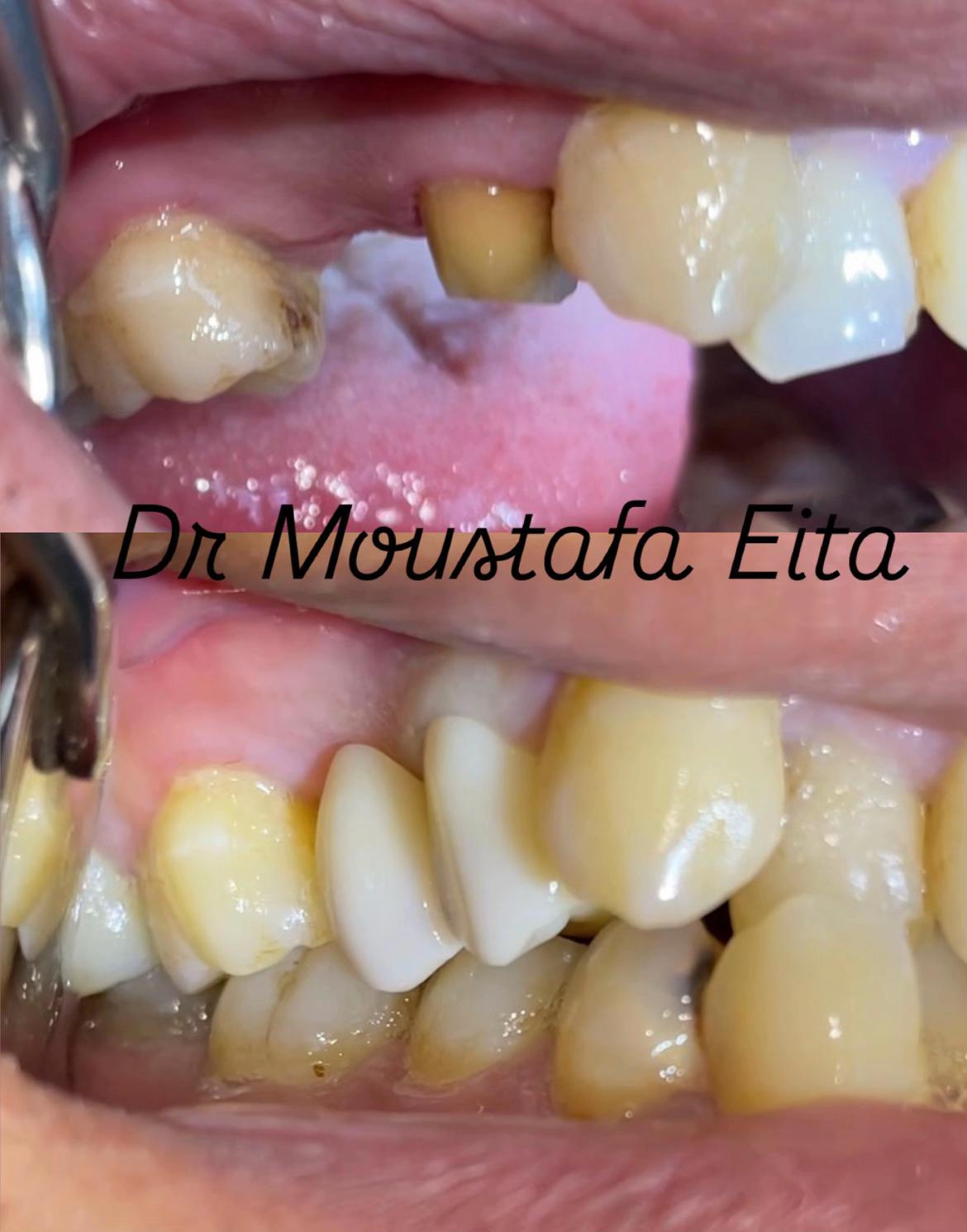 @Dr Mostafa Eita