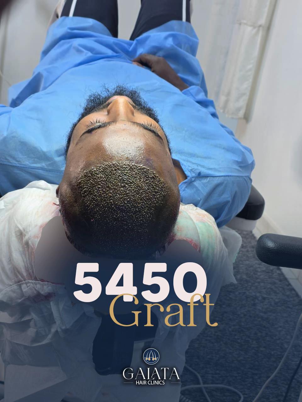@galata_hair_clinic