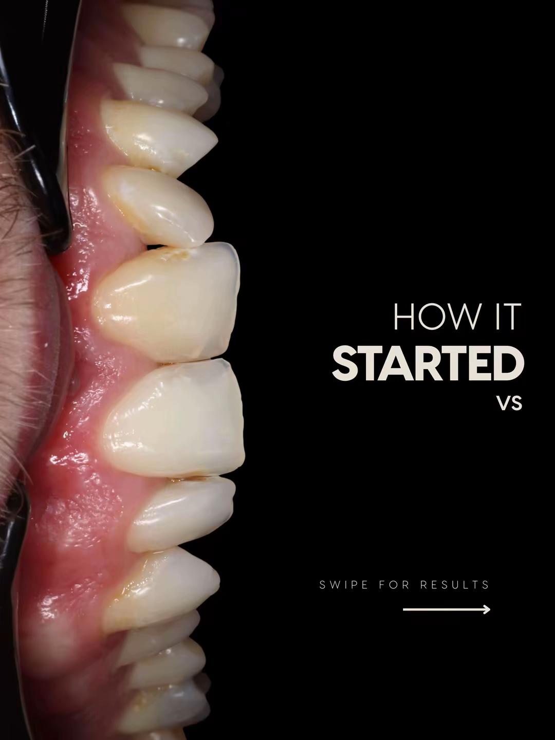 @Dentalexcellenceuk