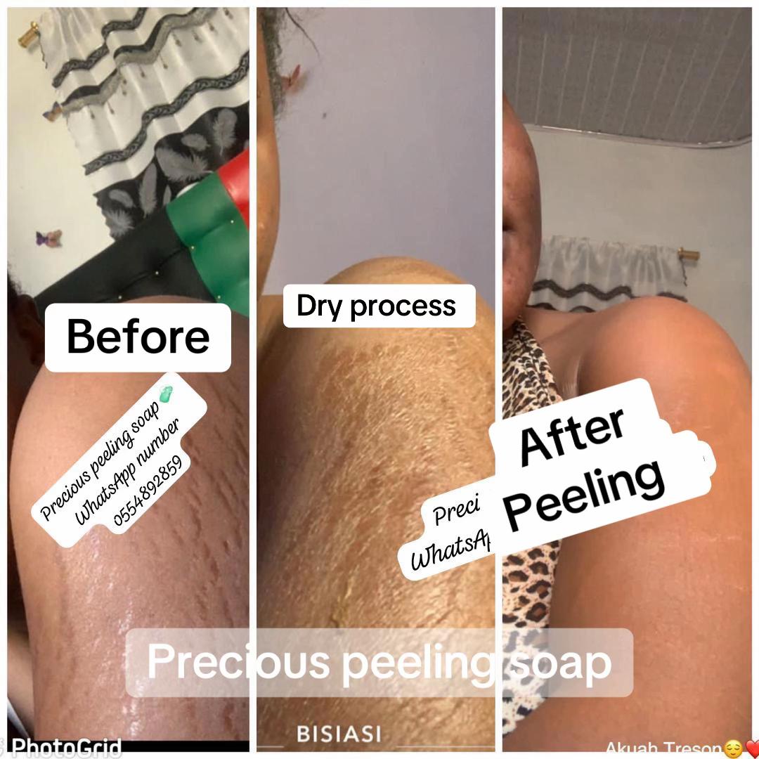 @@ Precious peeling soap