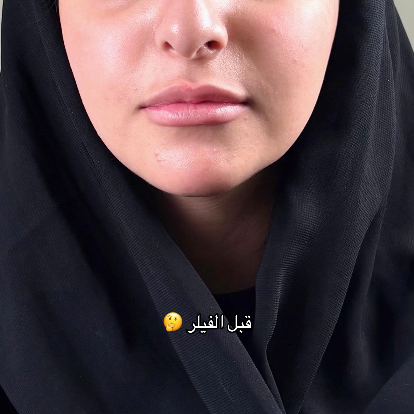 @مزدانه (فرع الملك عبدالله)
