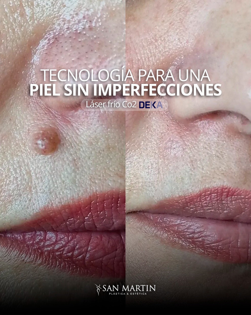 @Cl&iacute;nica San Mart&iacute;n