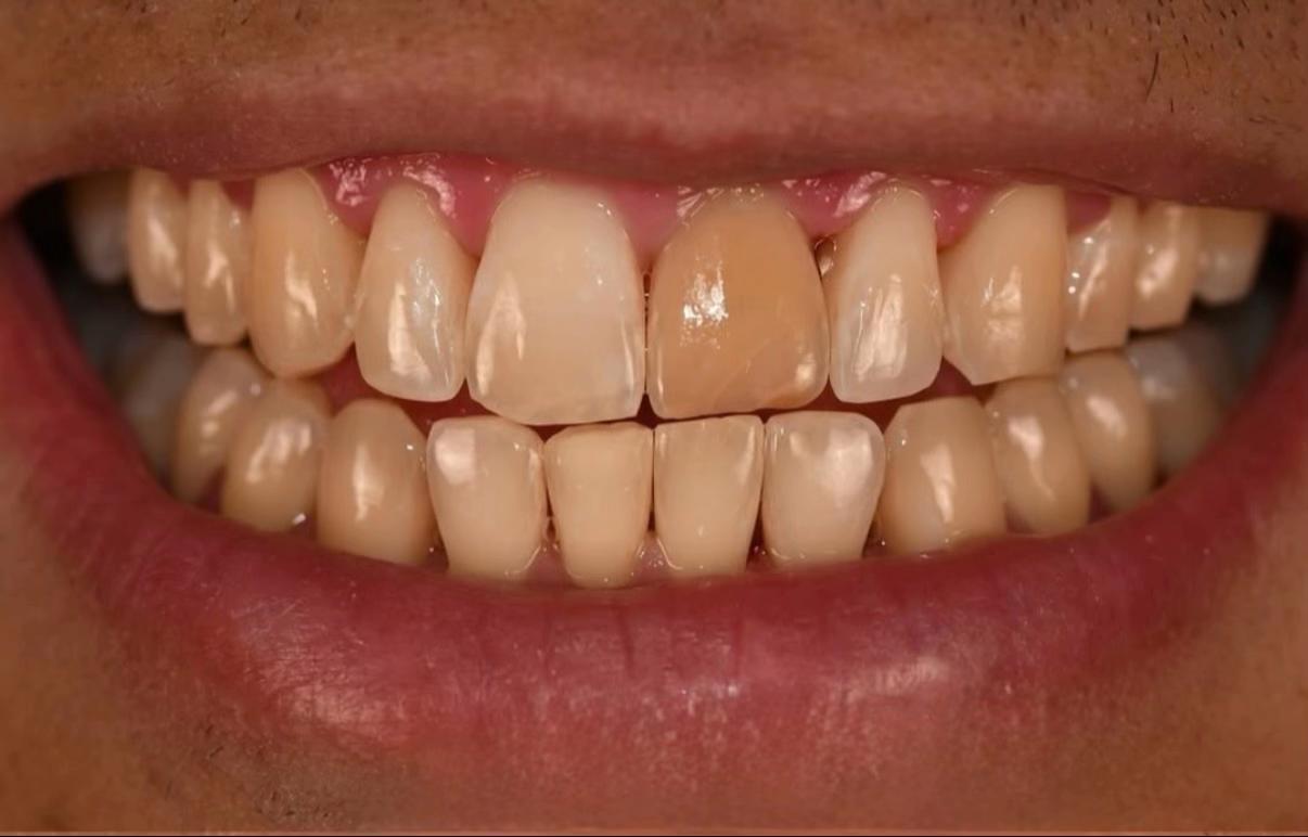 @Stomatolog Snejana Carabulea🦷
