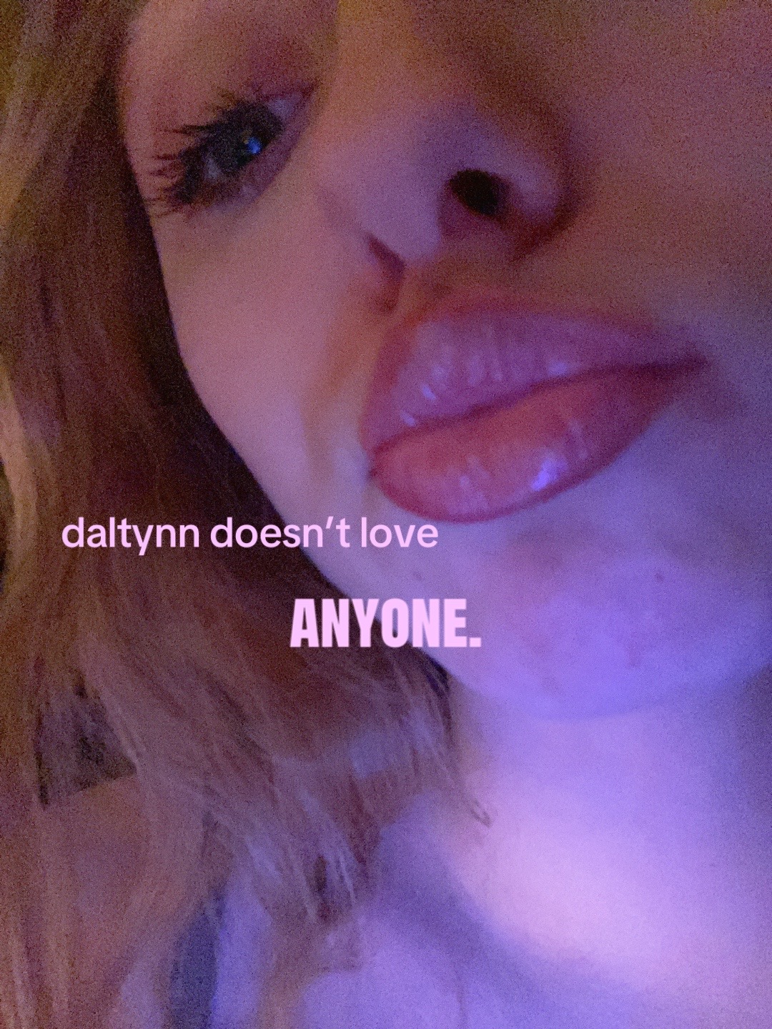 @𝘥𝘢𝘭𝘵𝘺𝘯𝘯𝘭𝘰𝘷𝘦𝘻𝘺𝘰𝘶
