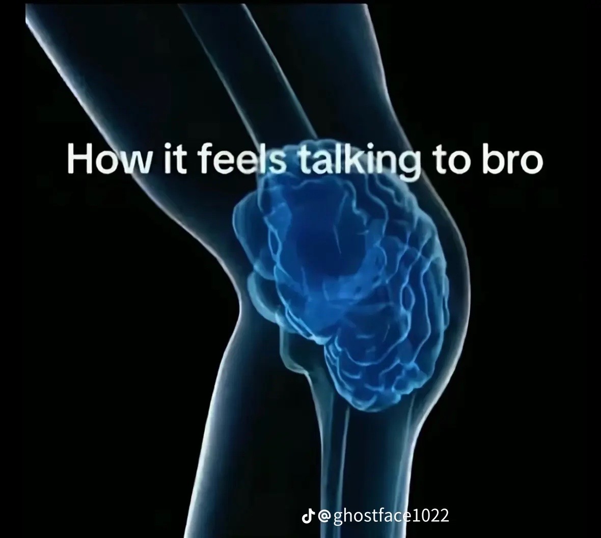 @ŤŘǍČǏ💋✗ˑ𝘰
