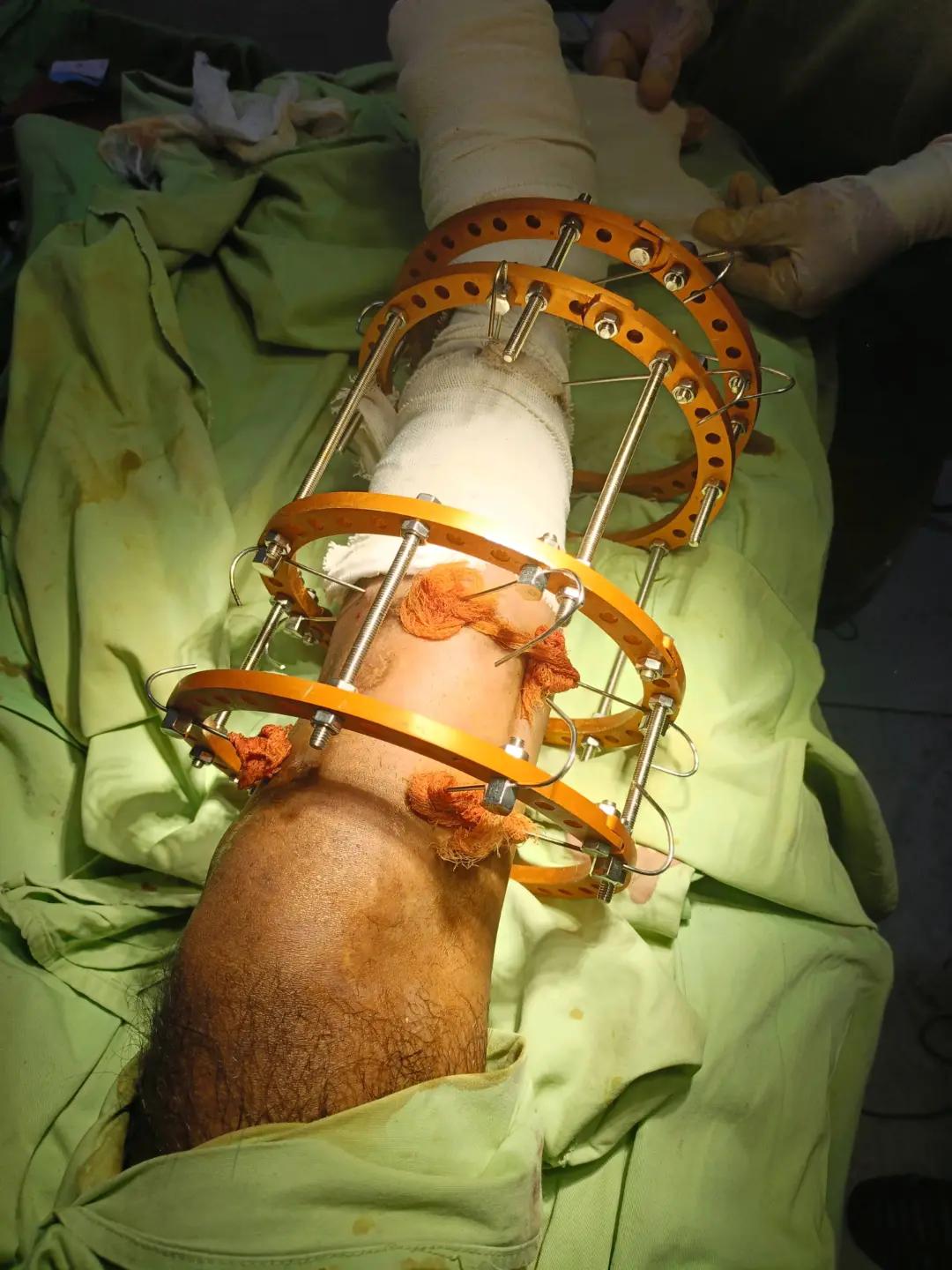 @Dr.Ghazanfar | Ortho Surgeon