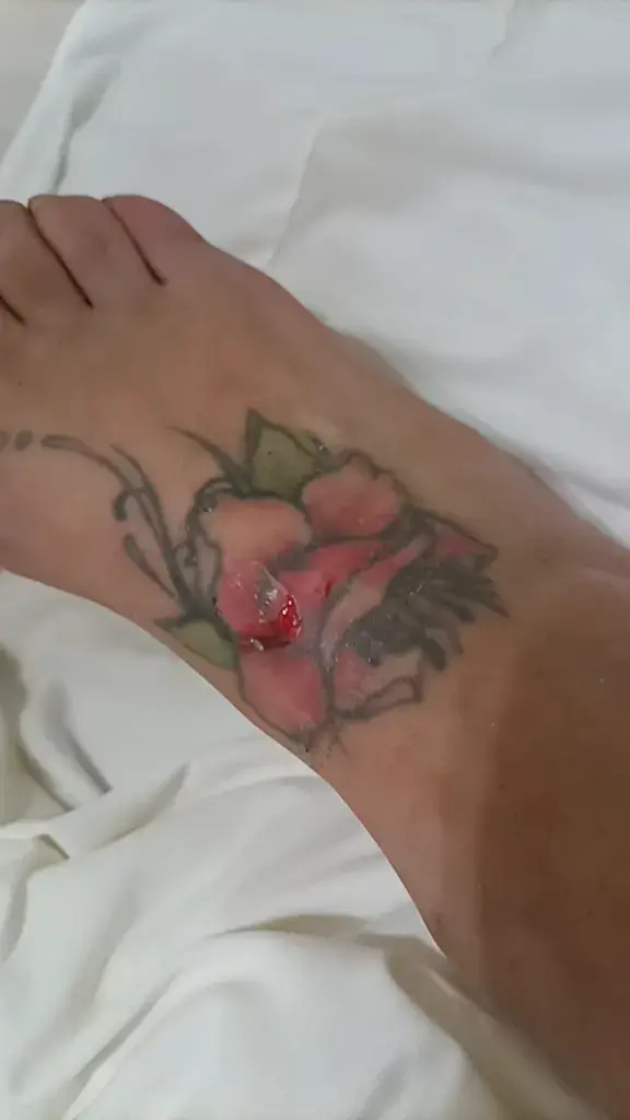 @Valentina pupa
