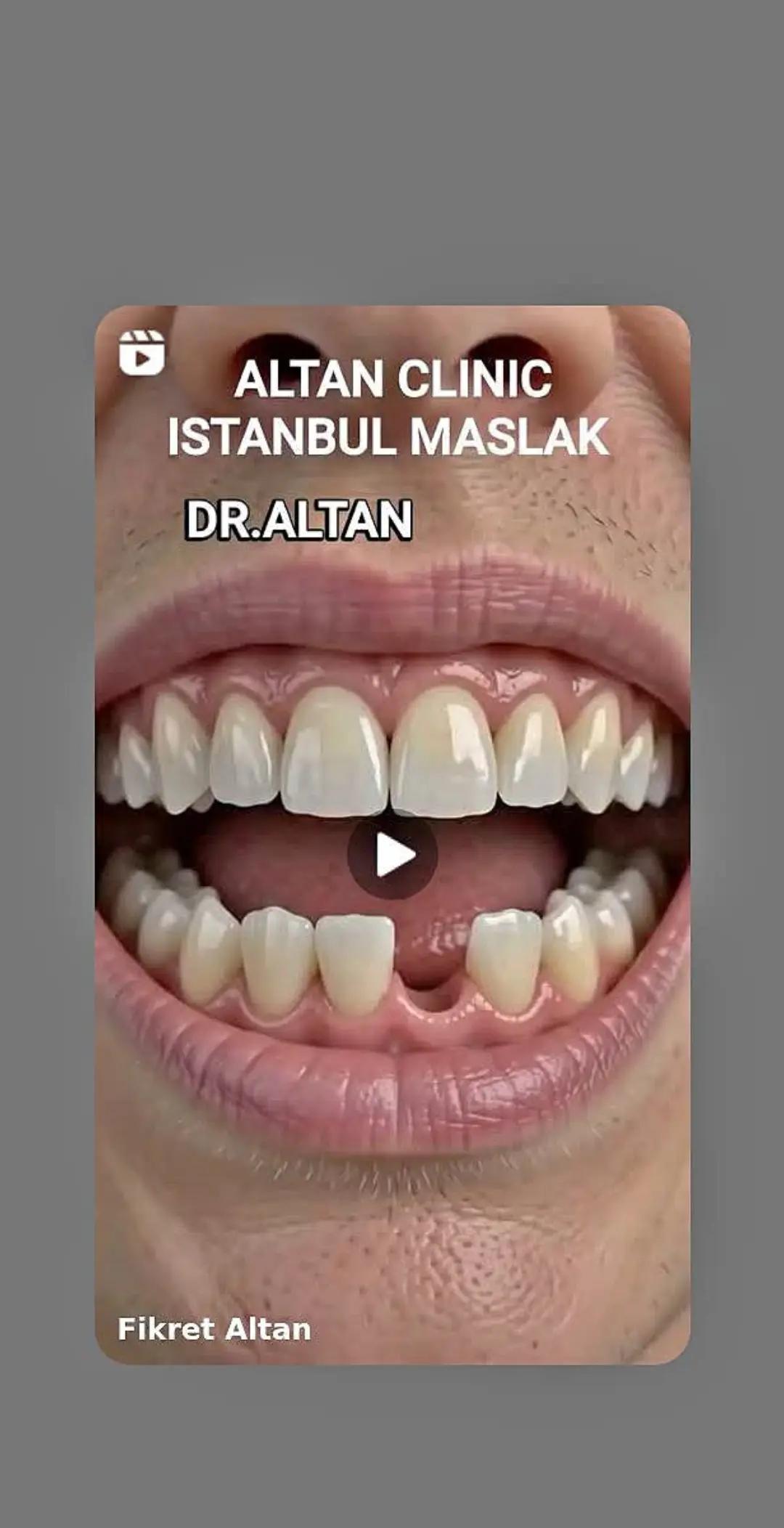 @DişHekimi Fikret Altan Dentist