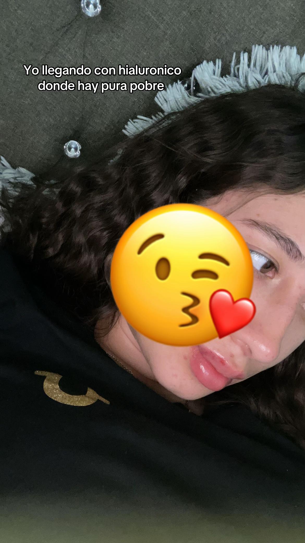 @Avmm