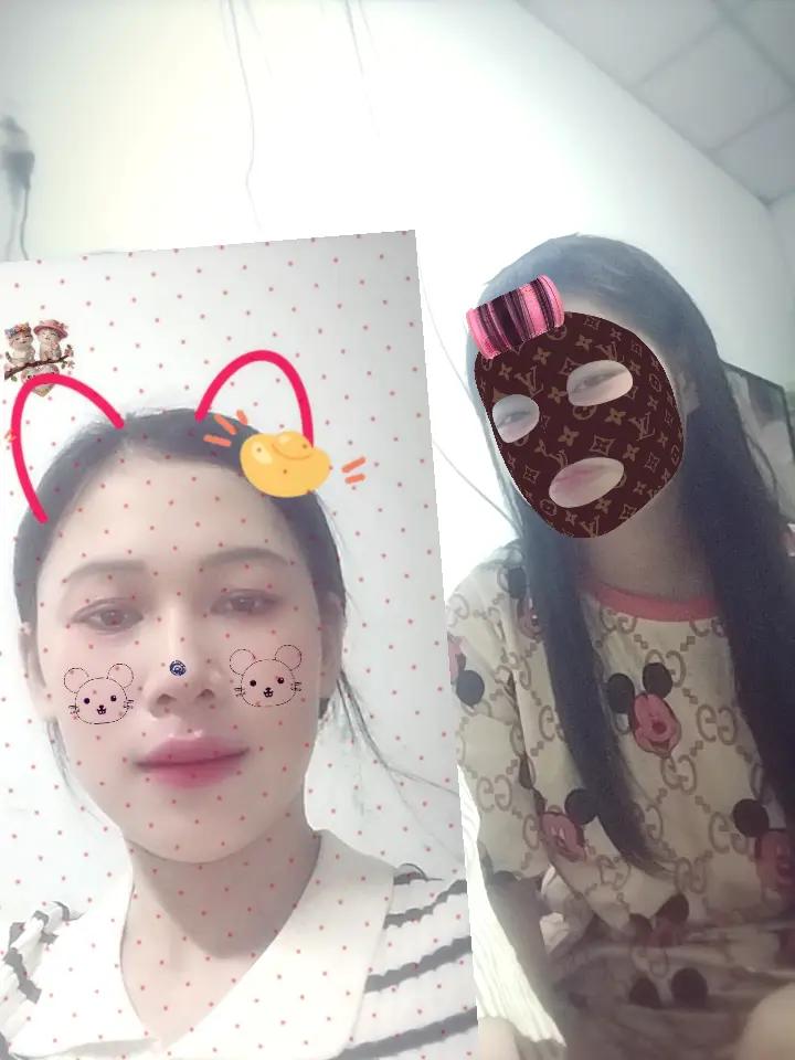 @🍒&uacute;t thăm 🍒