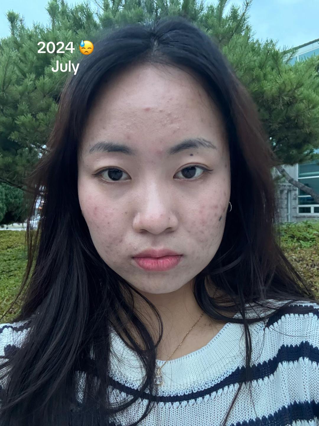 @Monika limbu7