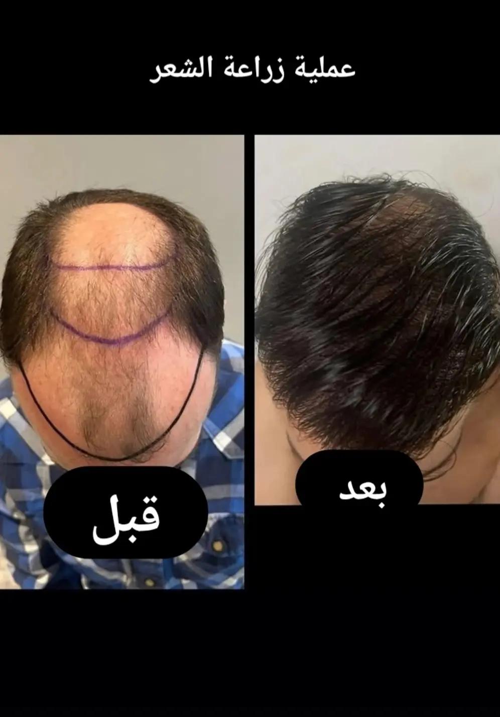 @Bouricha Beya