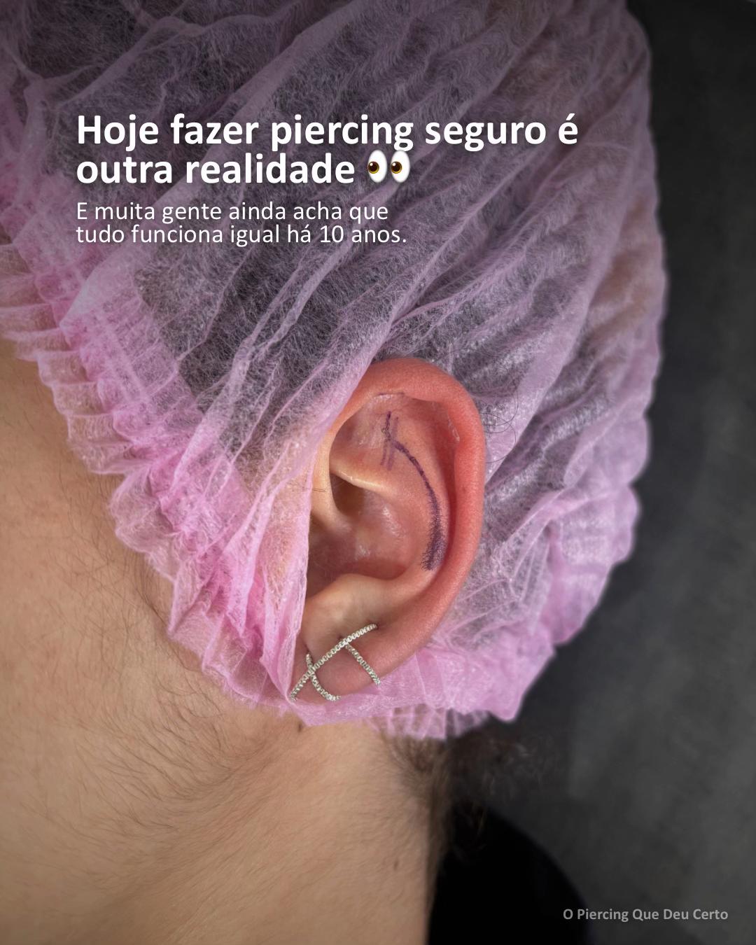 @Igor Sudano