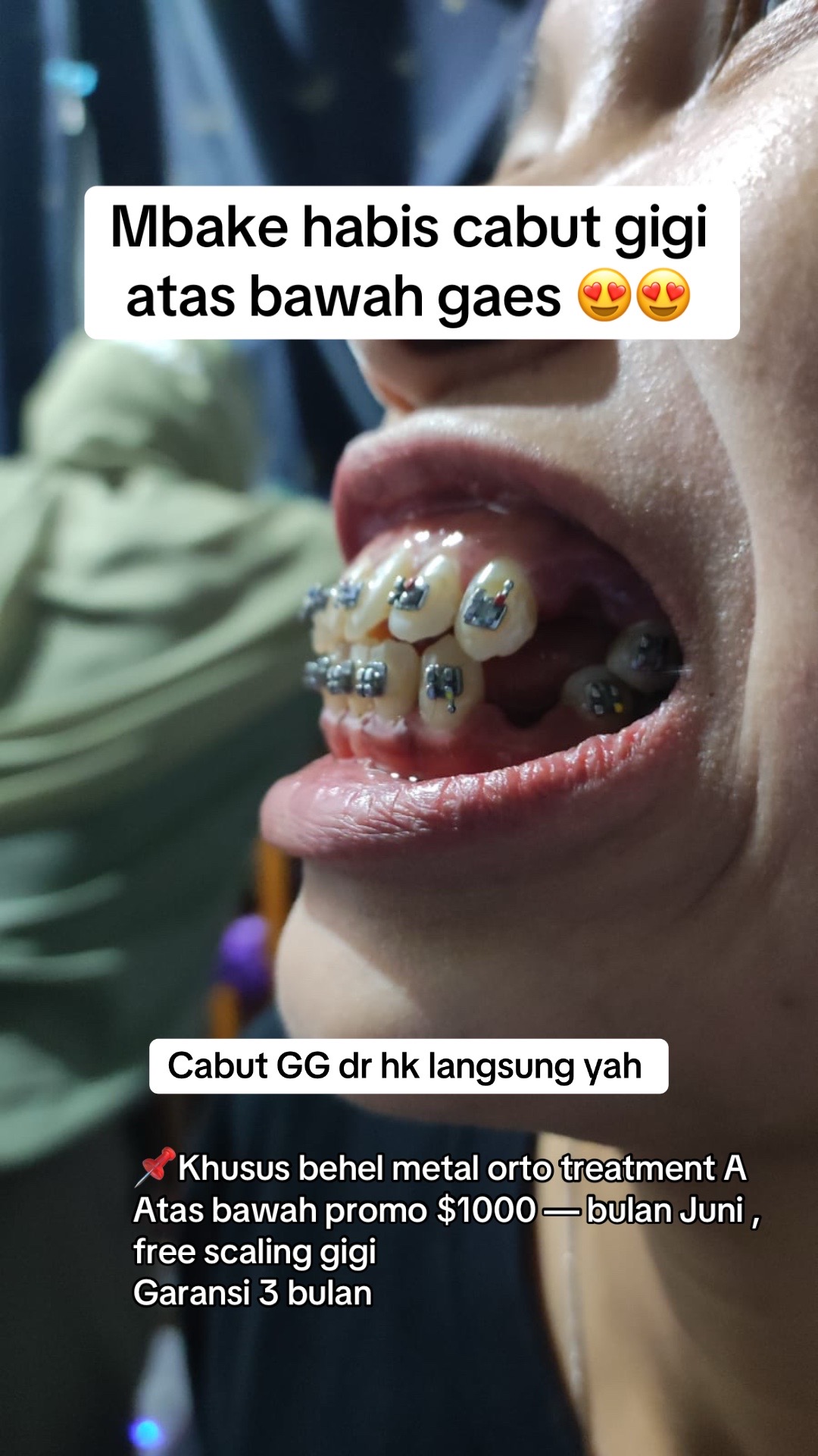 @mbak-Paijem