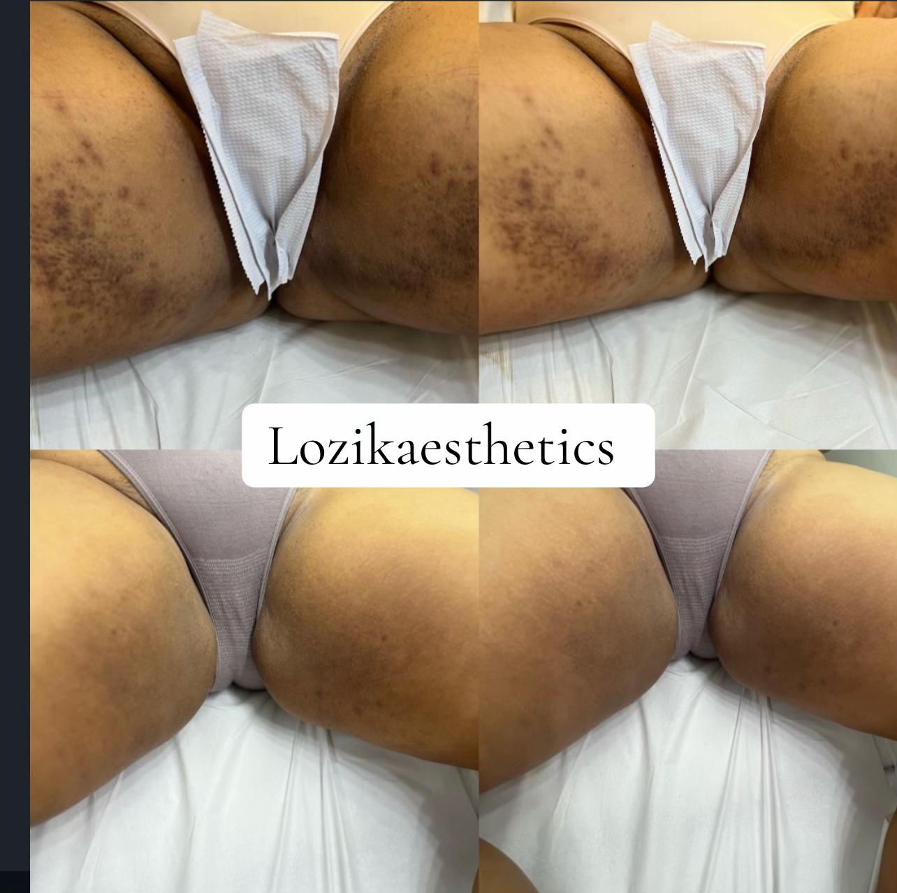 @LOZIK AESTHETICS | SPA IN AJAH