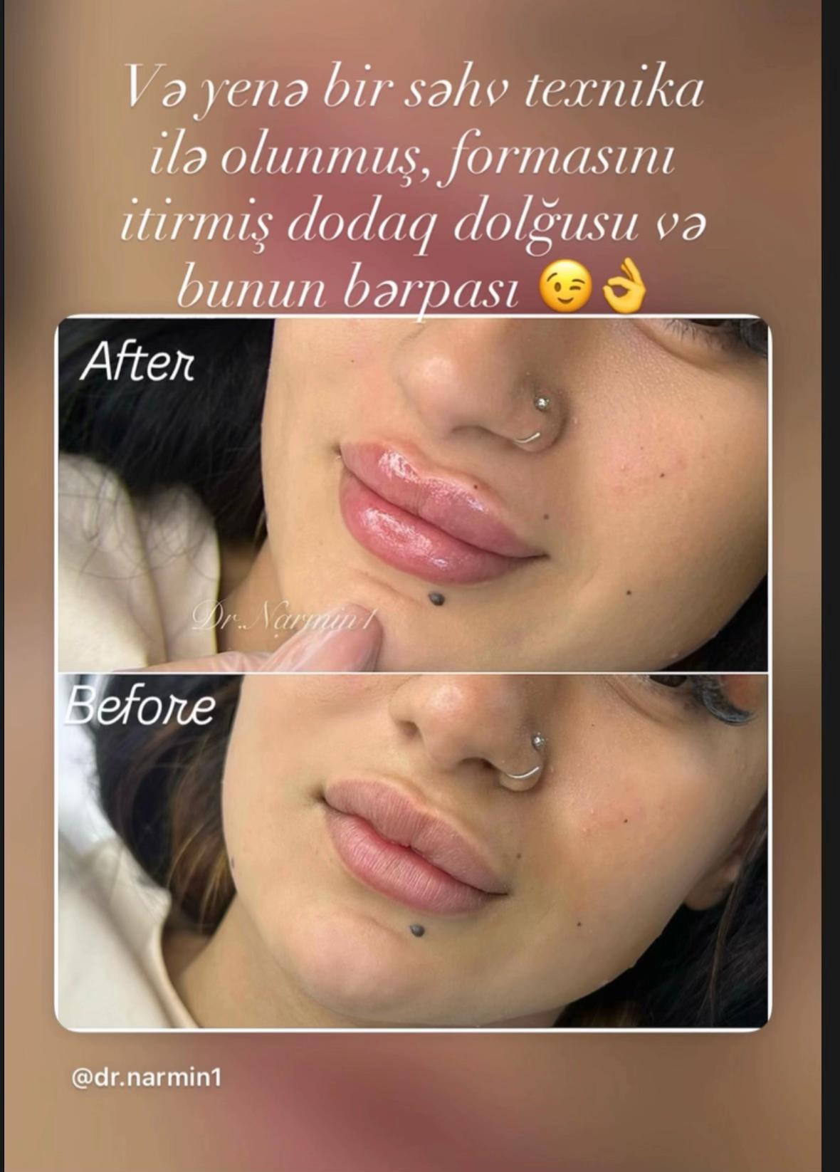 @Pm.N_permanent.marneuli