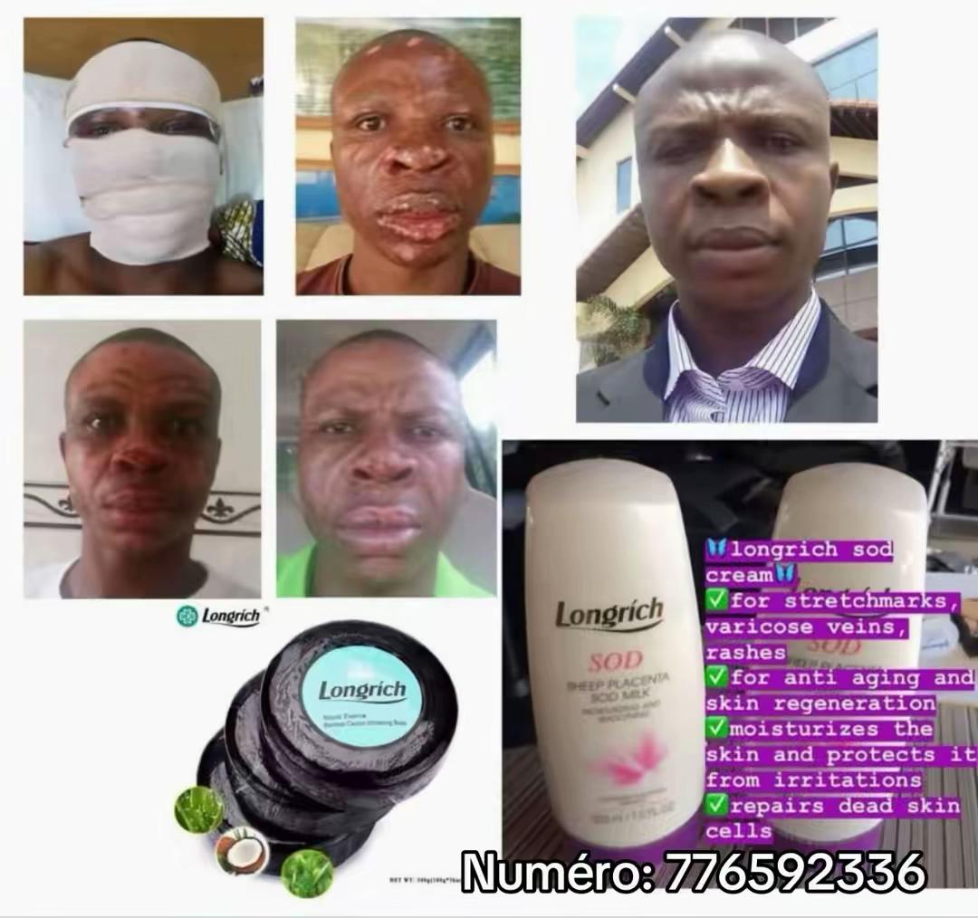 @Longrich_senegal