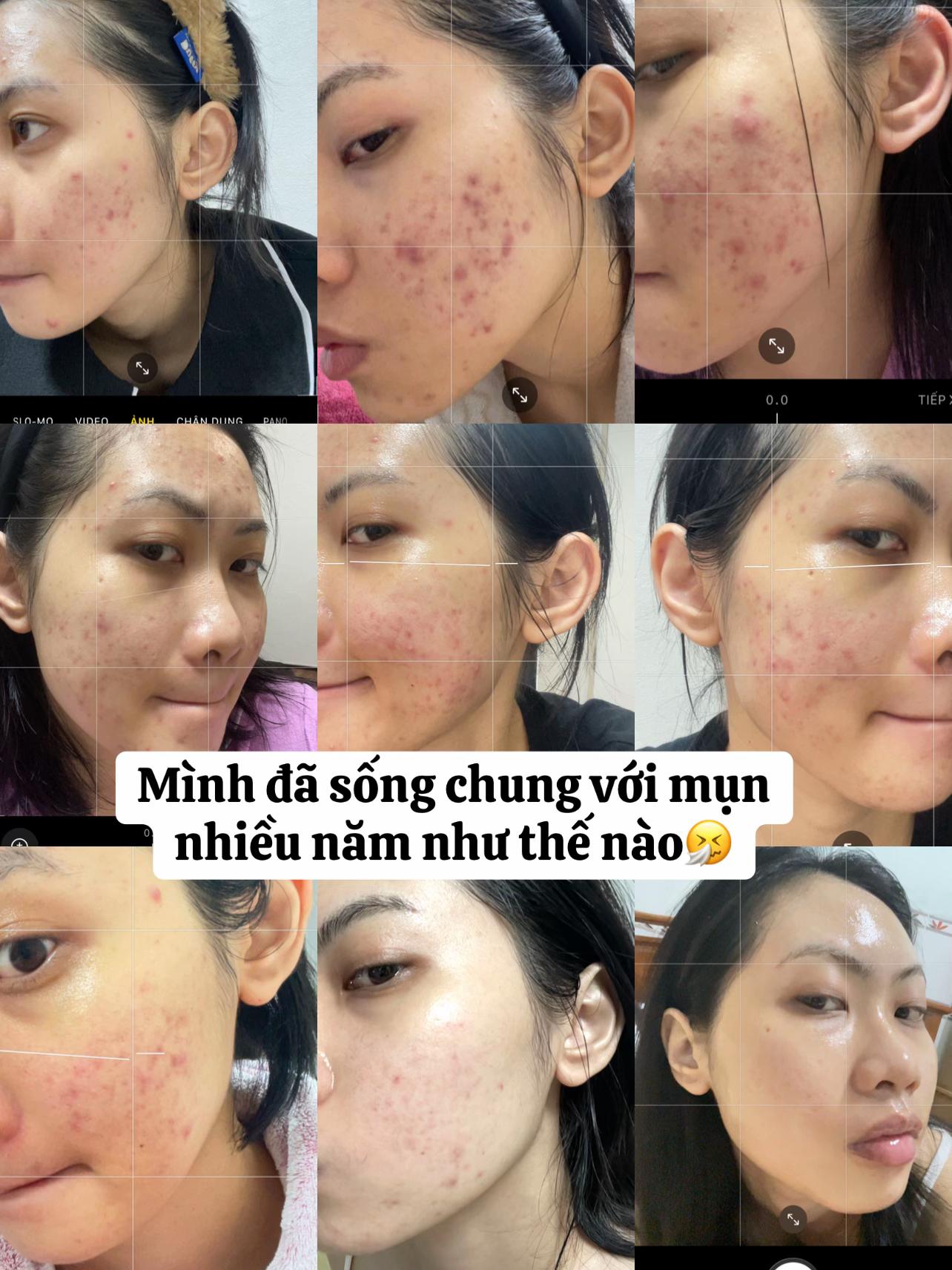 @Glowup with Minh