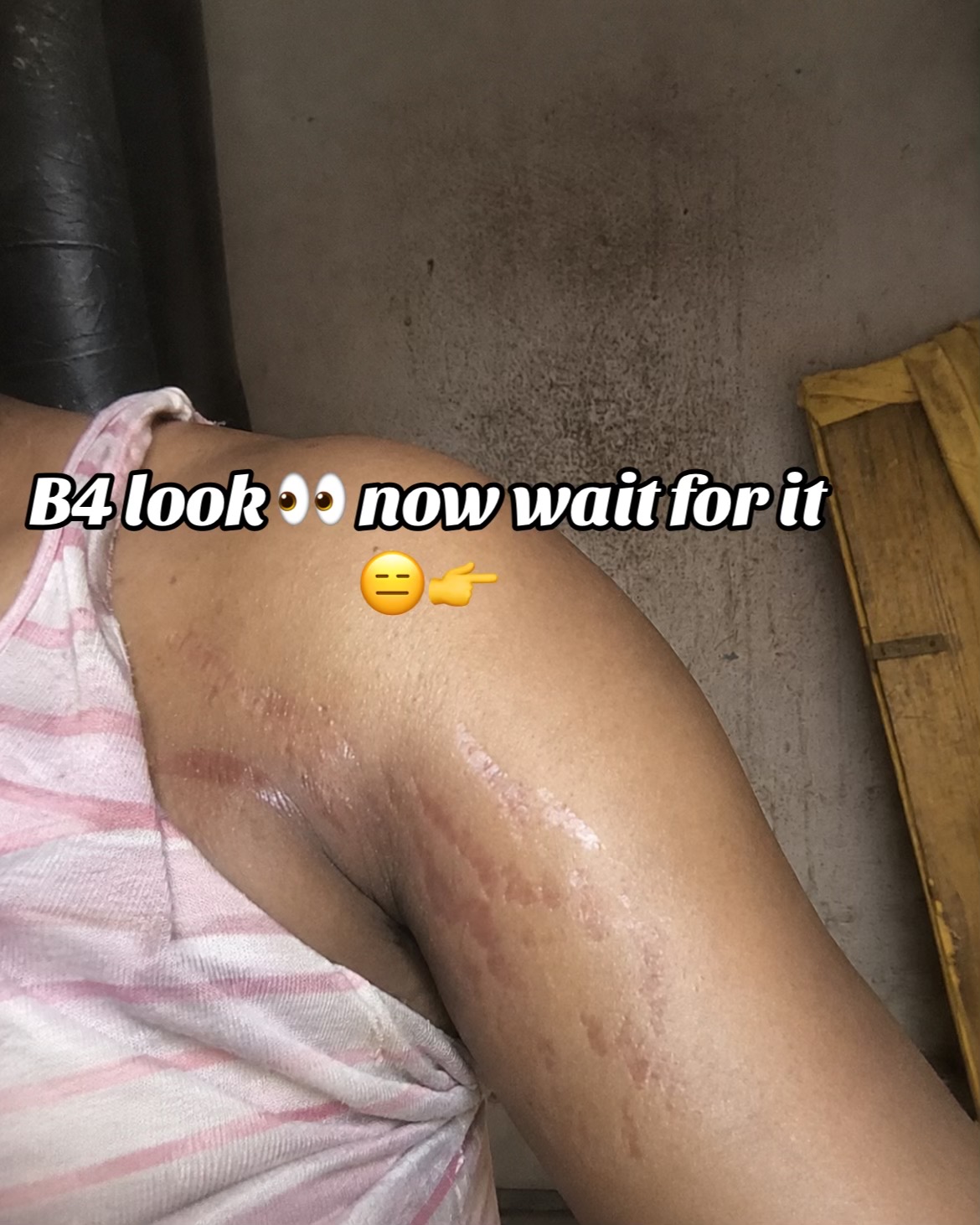 @Radiant skin