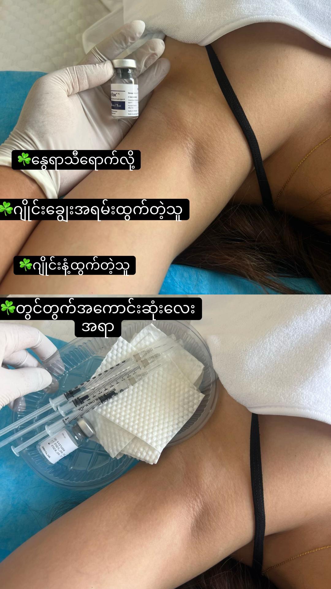 @JaJa (April Nu Beauty Clinic)