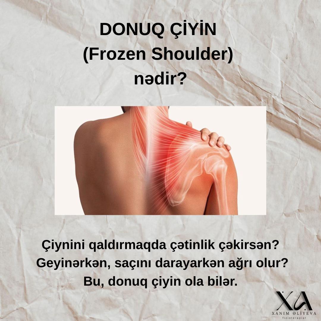 @Uzman Fzt Xanım Əliyeva