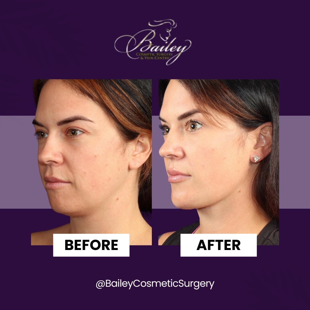 @BaileyCosmeticandVeinCenter