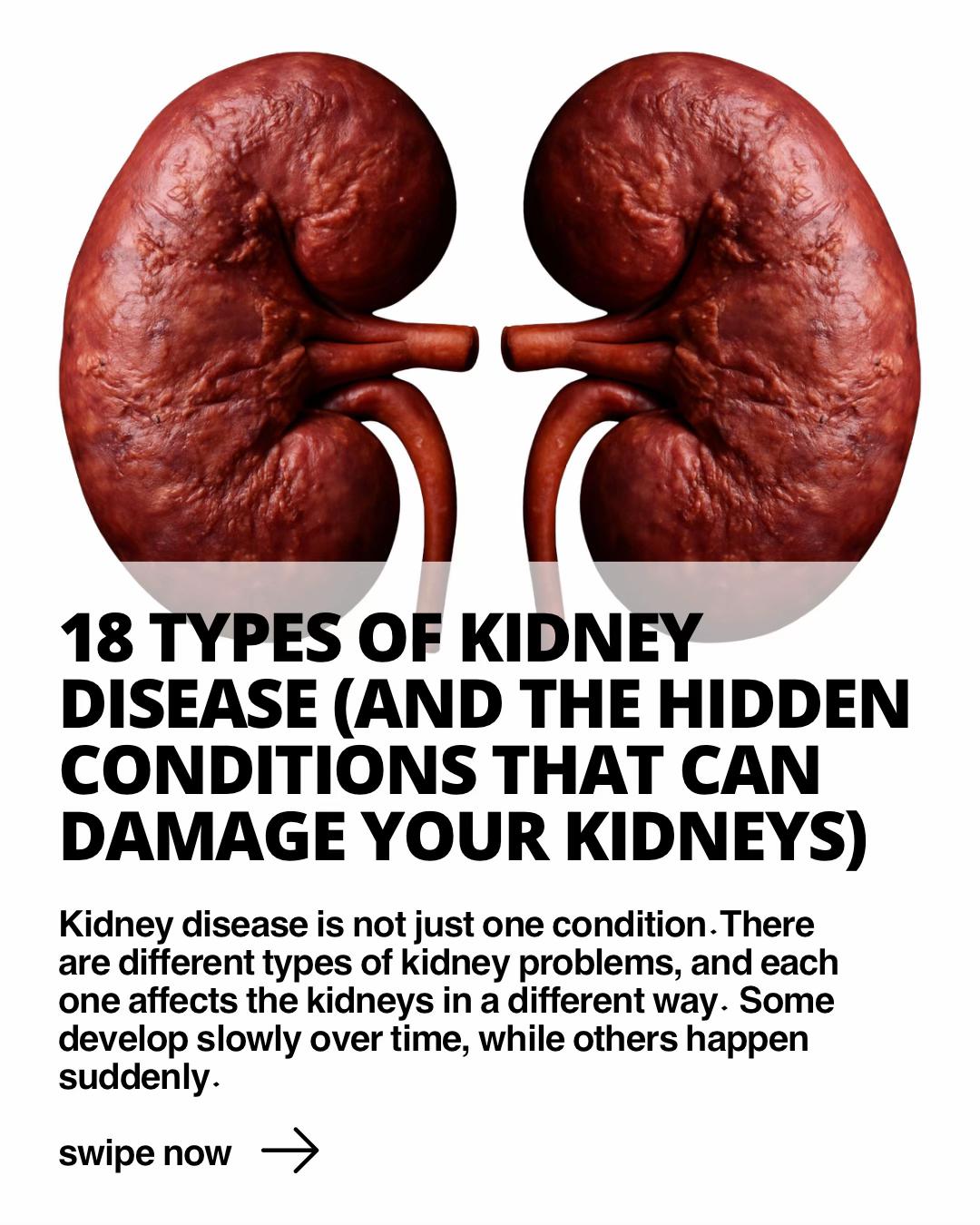 @Kidneysolution
