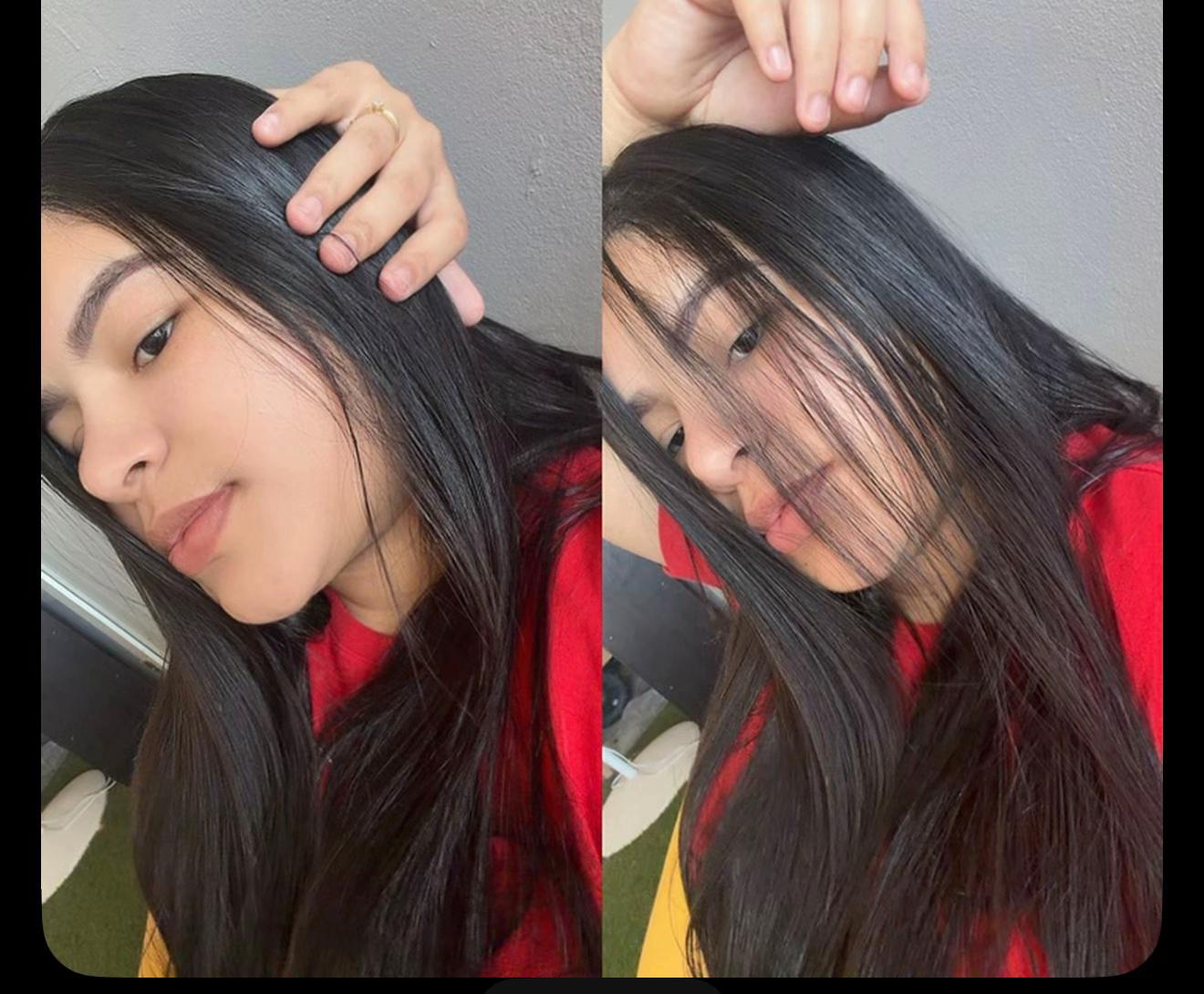 @Yaidilin Leidenz