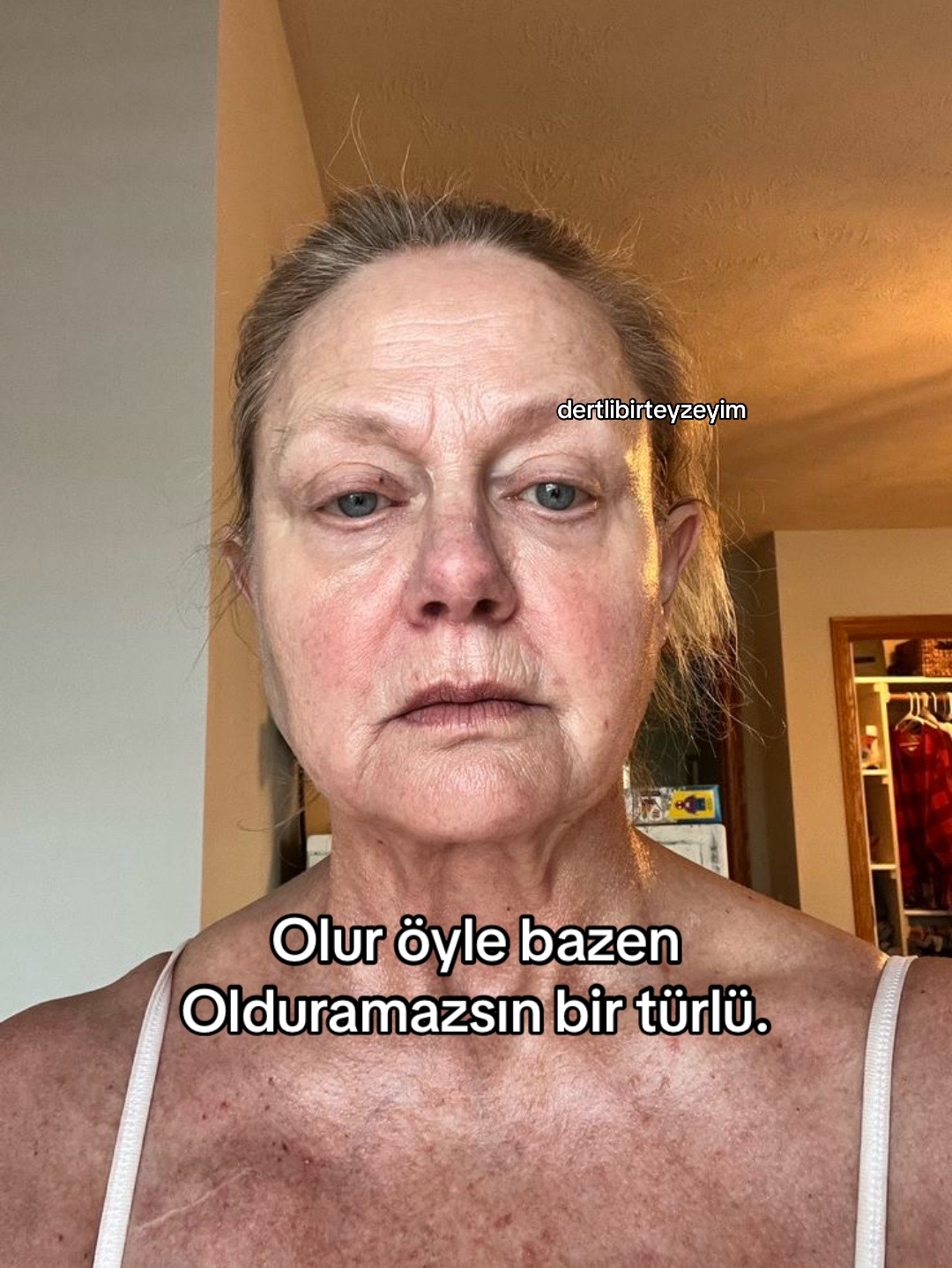 @dertlibirteyzeyim