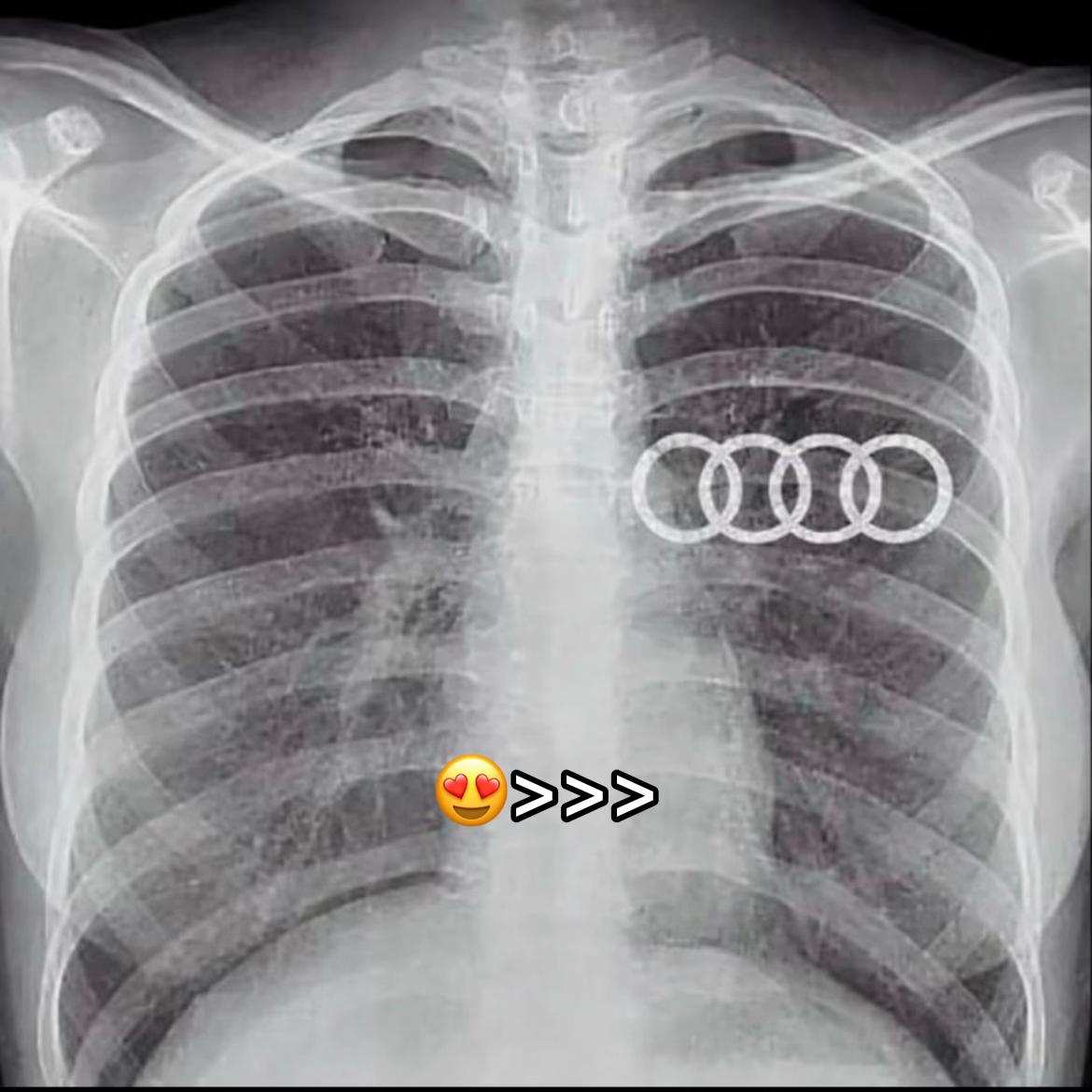 @Ashraf +39๐ฎ๐น๐